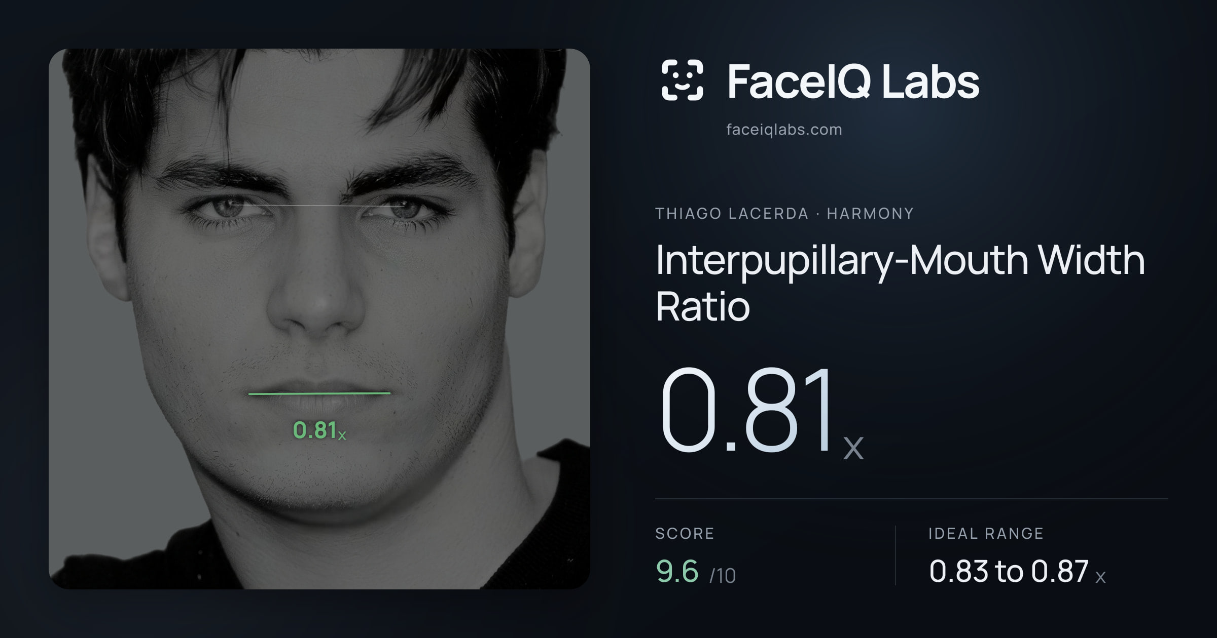 Thiago Lacerda Interpupillary-Mouth Width Ratio: 0.81x, drawn on the photo