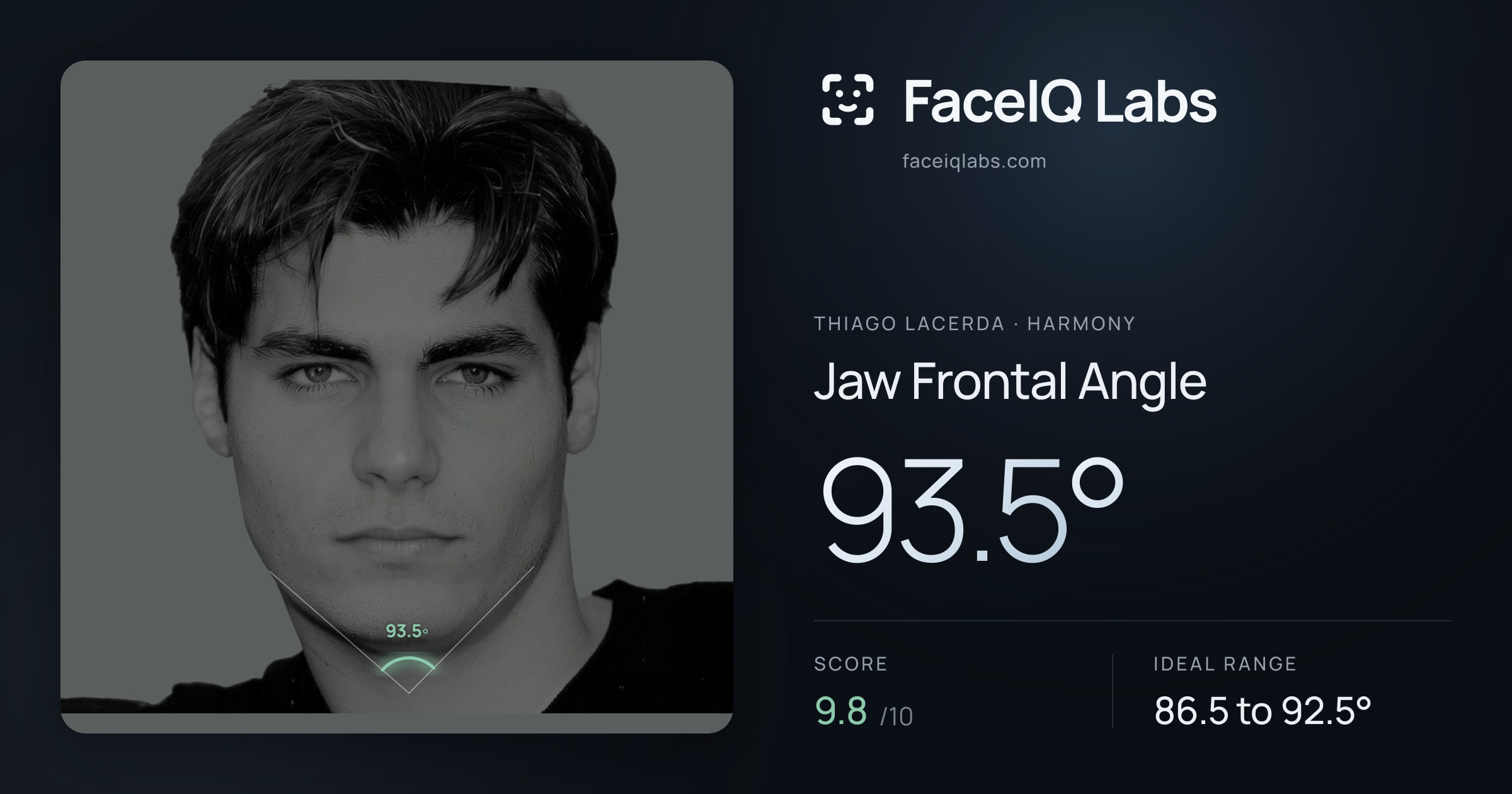 Thiago Lacerda Jaw Frontal Angle: 93.5°, drawn on the photo