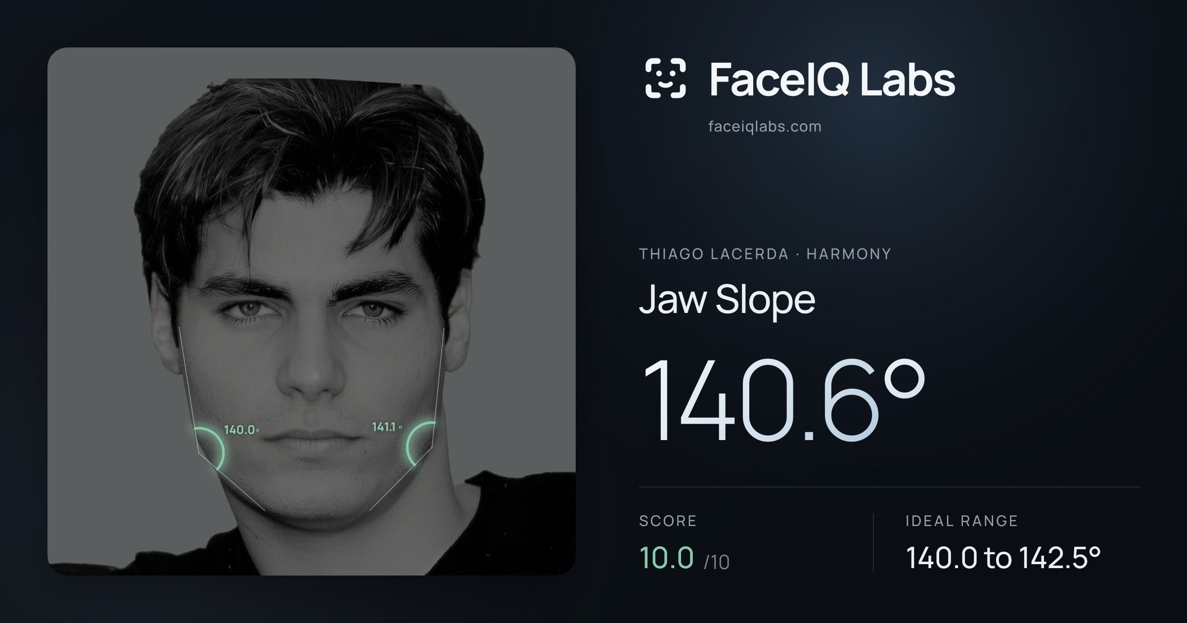 Thiago Lacerda Jaw Slope: 140.6°, drawn on the photo