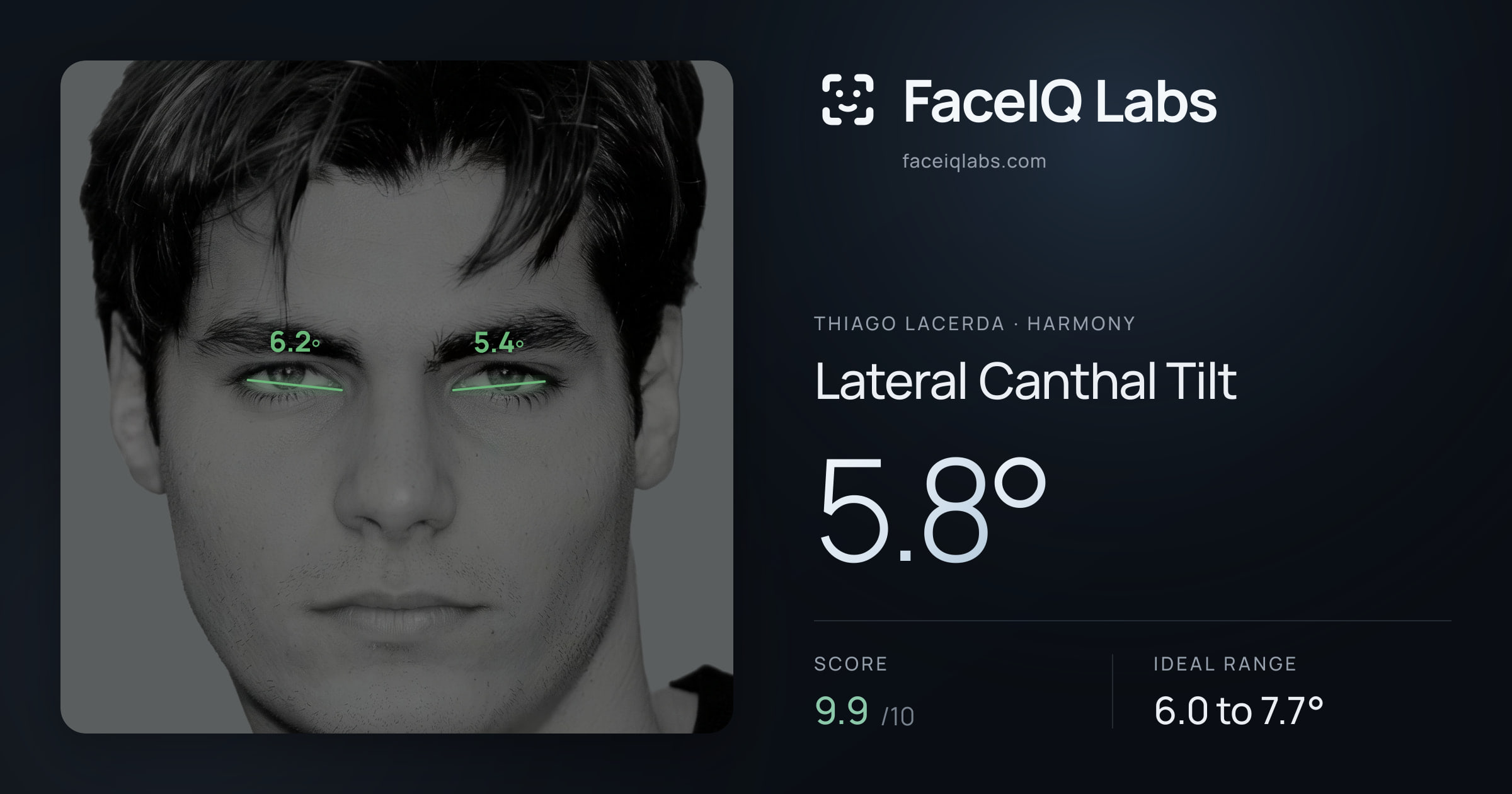 Thiago Lacerda Lateral Canthal Tilt: 5.8°, drawn on the photo
