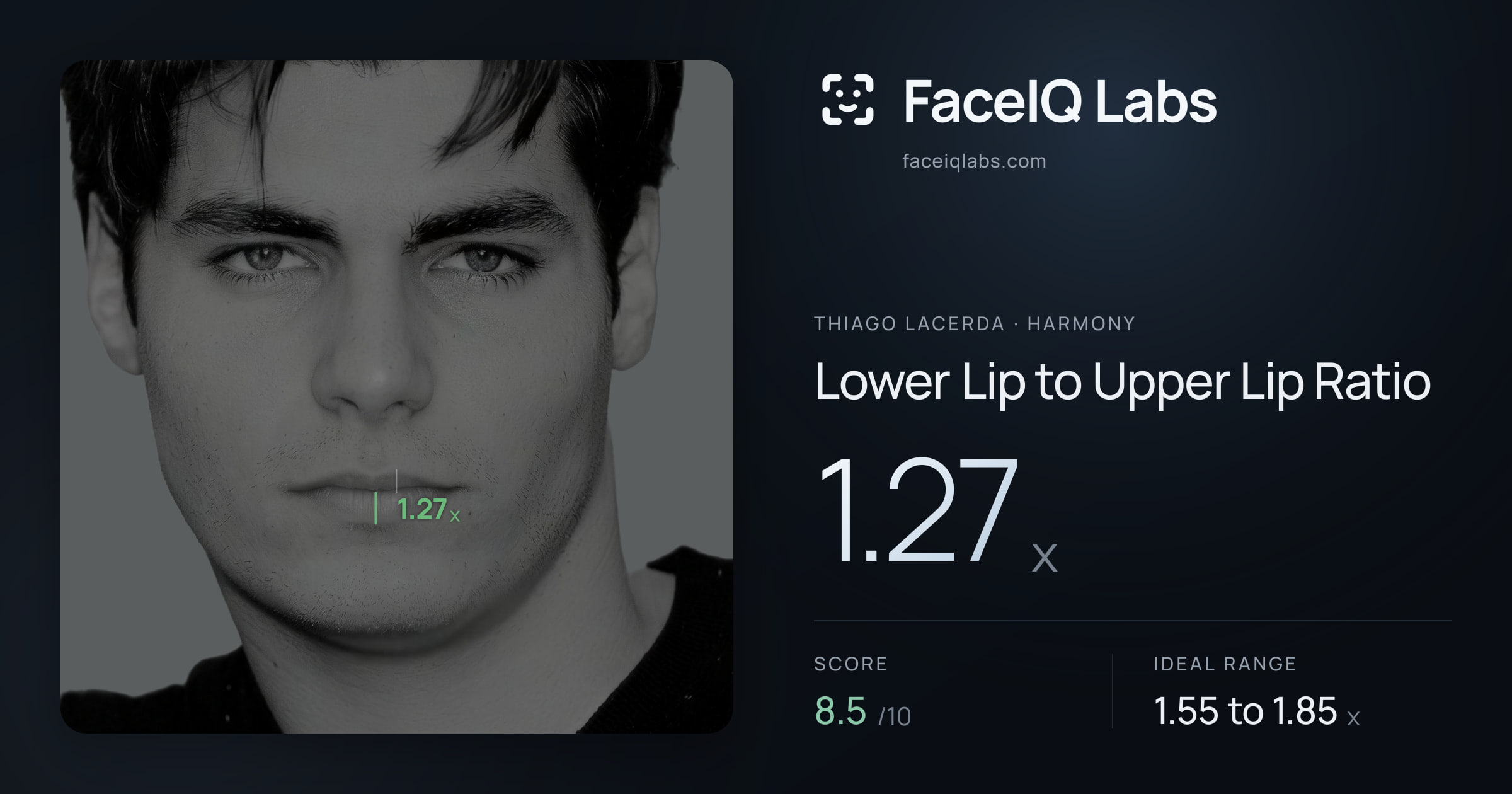 Thiago Lacerda Lower Lip to Upper Lip Ratio: 1.27x, drawn on the photo