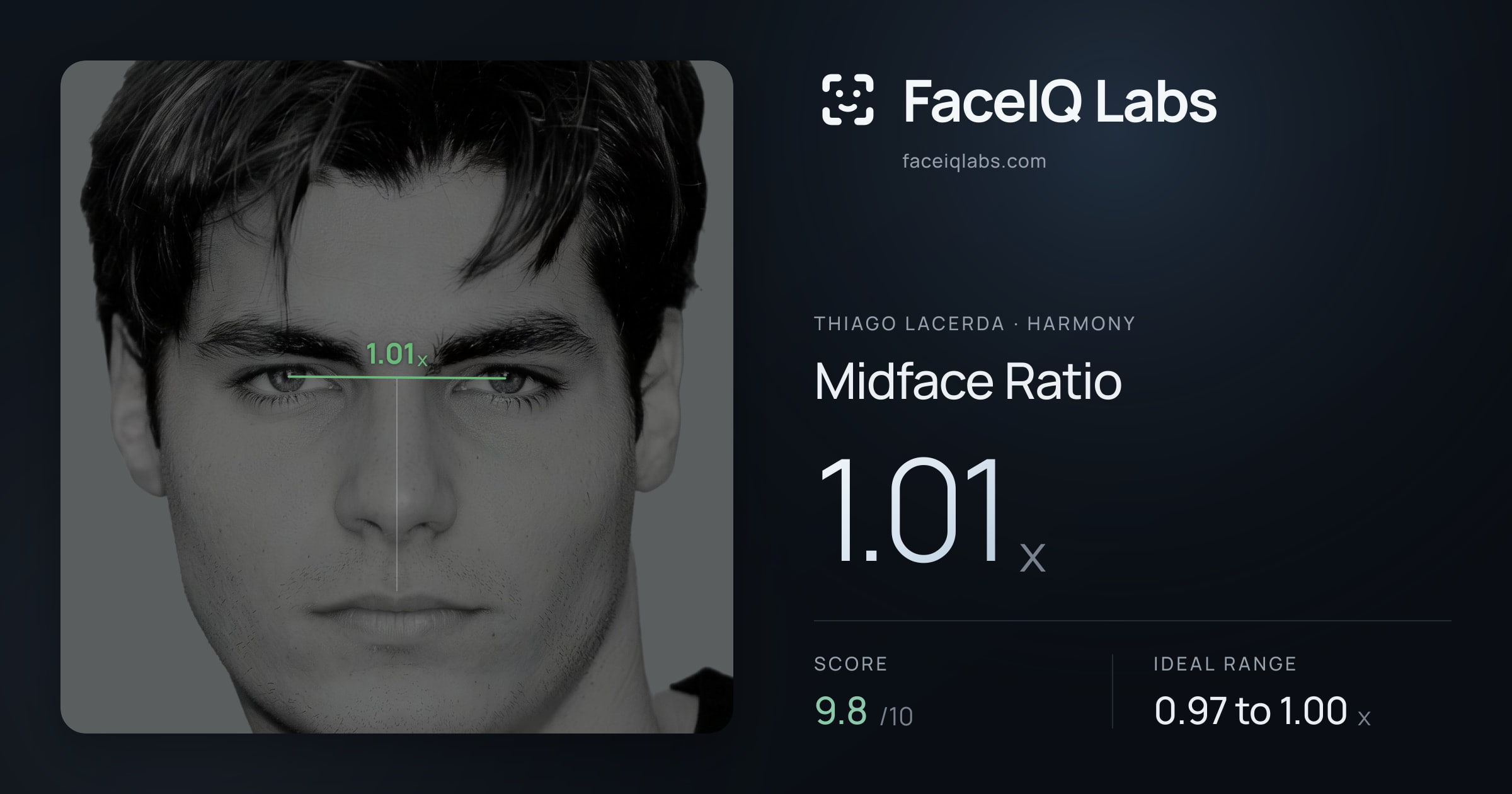 Thiago Lacerda Midface Ratio: 1.01x, drawn on the photo