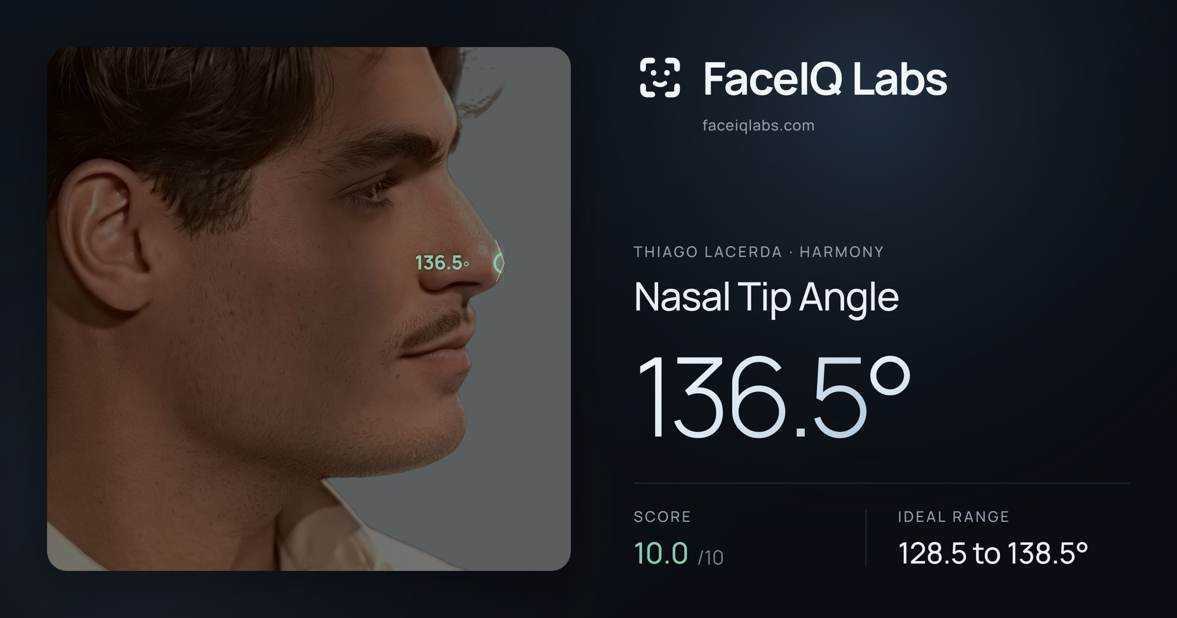 Thiago Lacerda Nasal Tip Angle: 136.5°, drawn on the photo