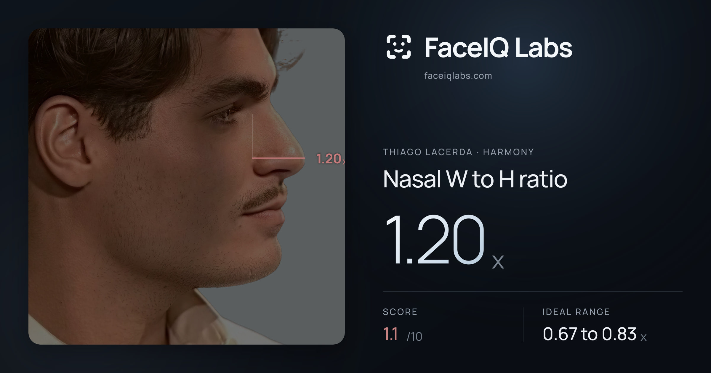 Thiago Lacerda Nasal W to H ratio: 1.20x, drawn on the photo