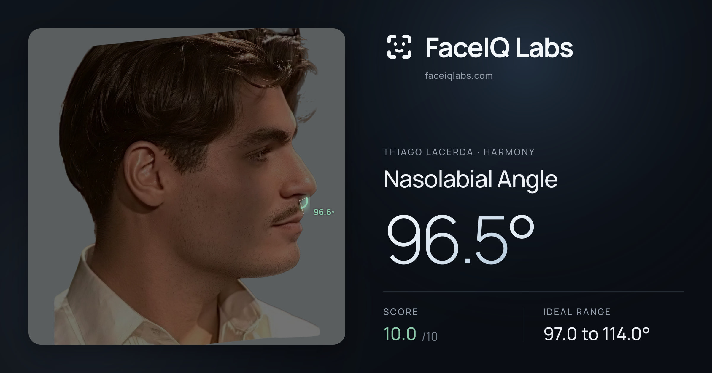Thiago Lacerda Nasolabial Angle: 96.5°, drawn on the photo
