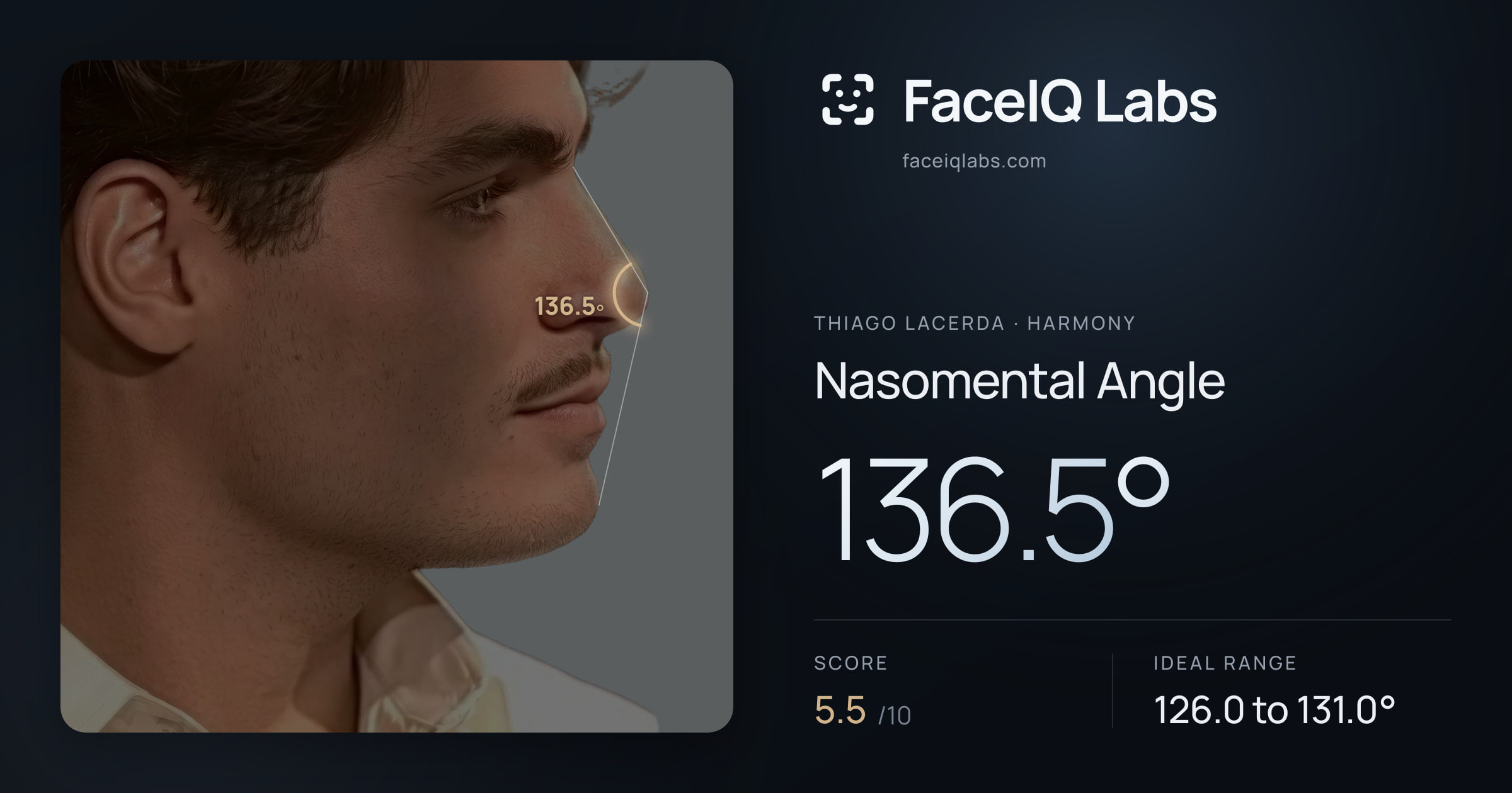 Thiago Lacerda Nasomental Angle: 136.5°, drawn on the photo