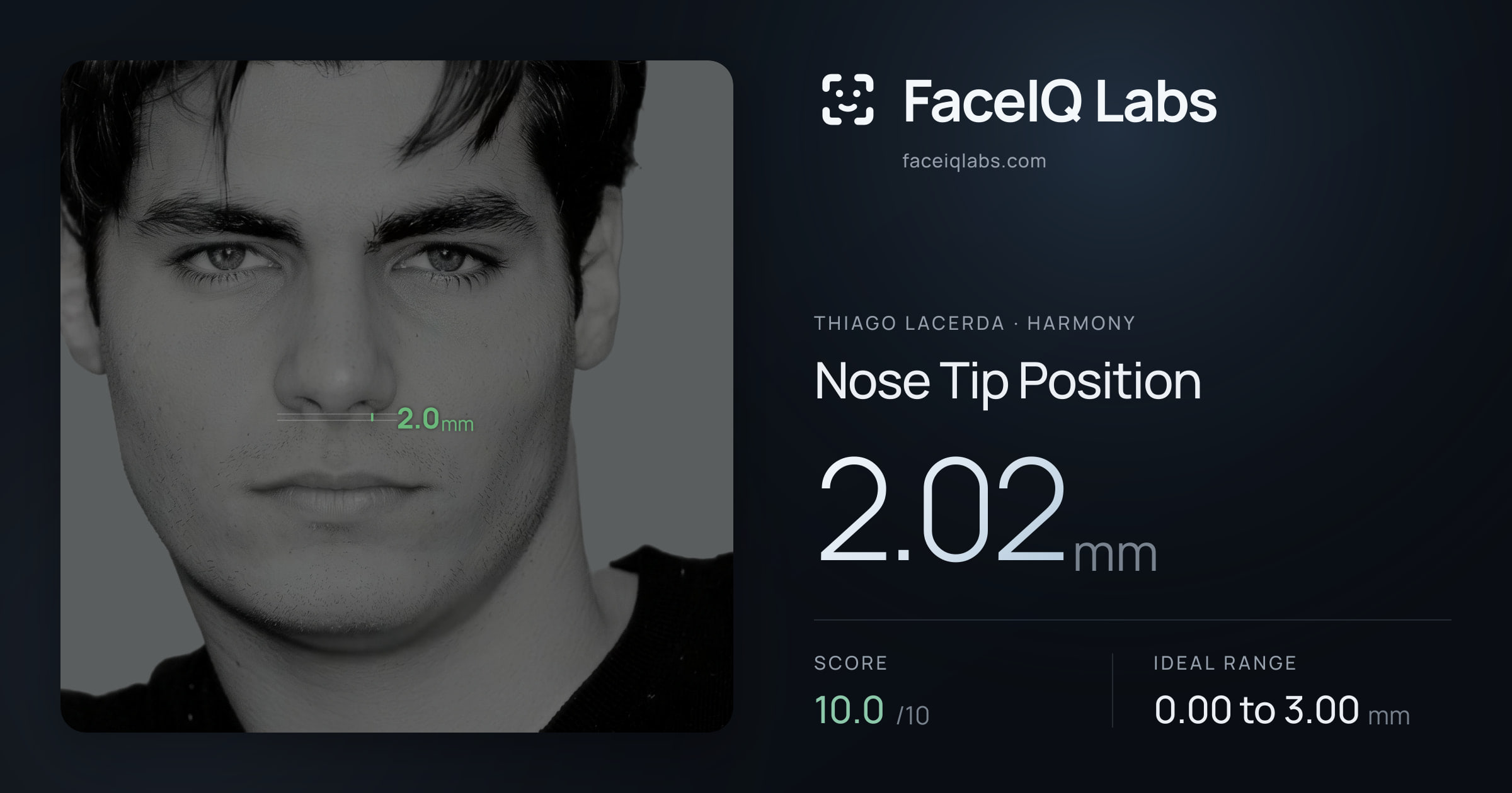 Thiago Lacerda Nose Tip Position: 2.02mm, drawn on the photo