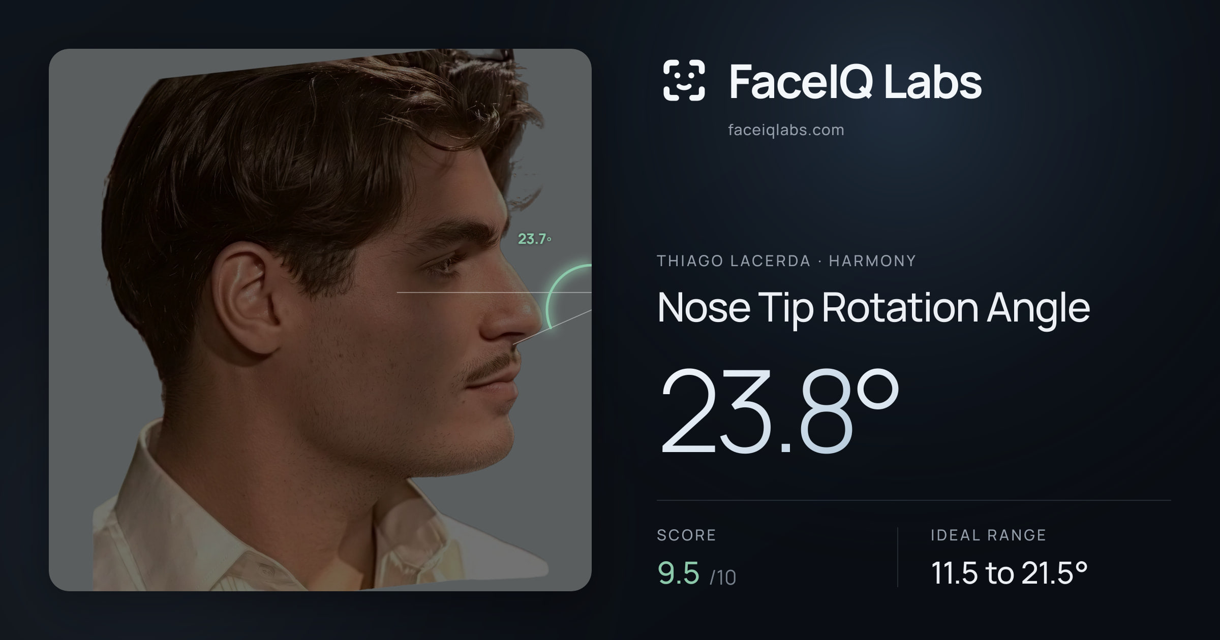 Thiago Lacerda Nose Tip Rotation Angle: 23.8°, drawn on the photo