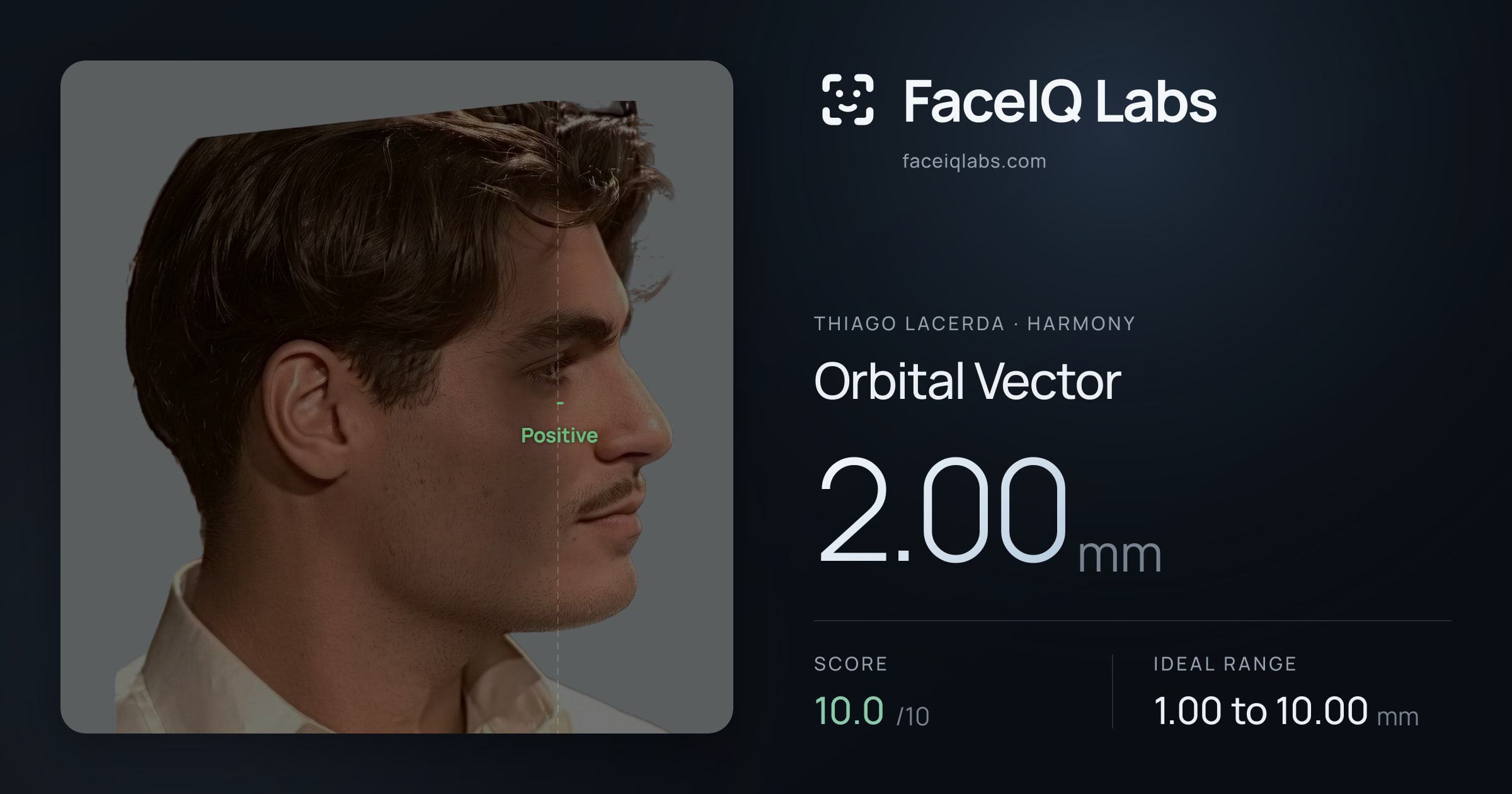 Thiago Lacerda Orbital Vector: 2.00mm, drawn on the photo