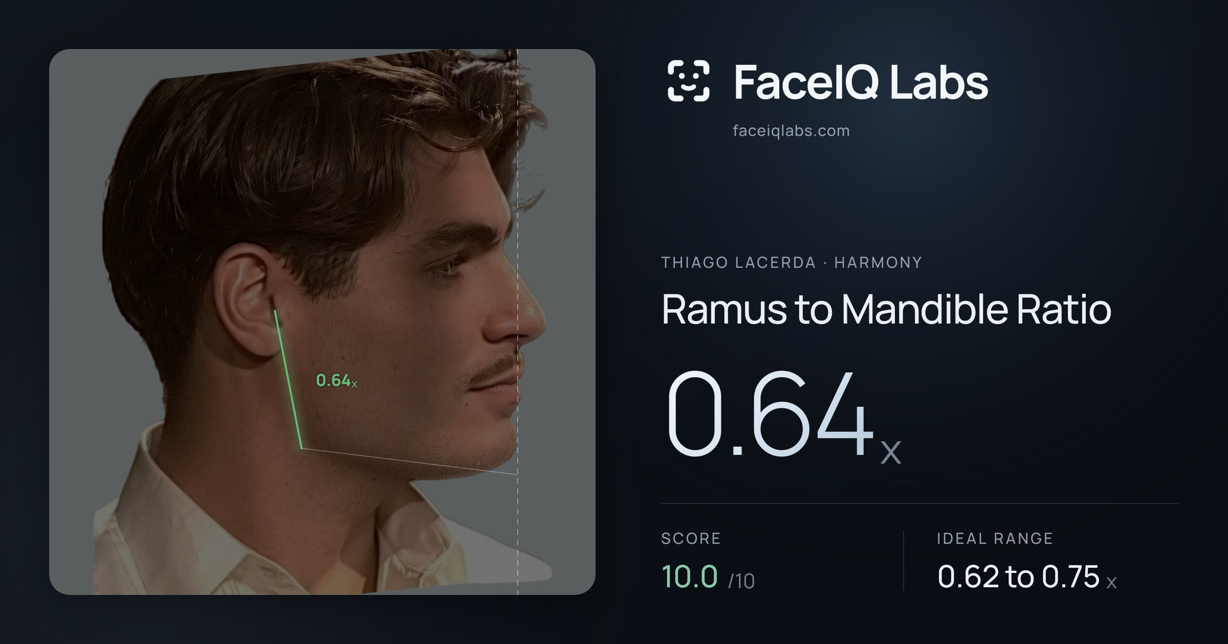 Thiago Lacerda Ramus to Mandible Ratio: 0.64x, drawn on the photo