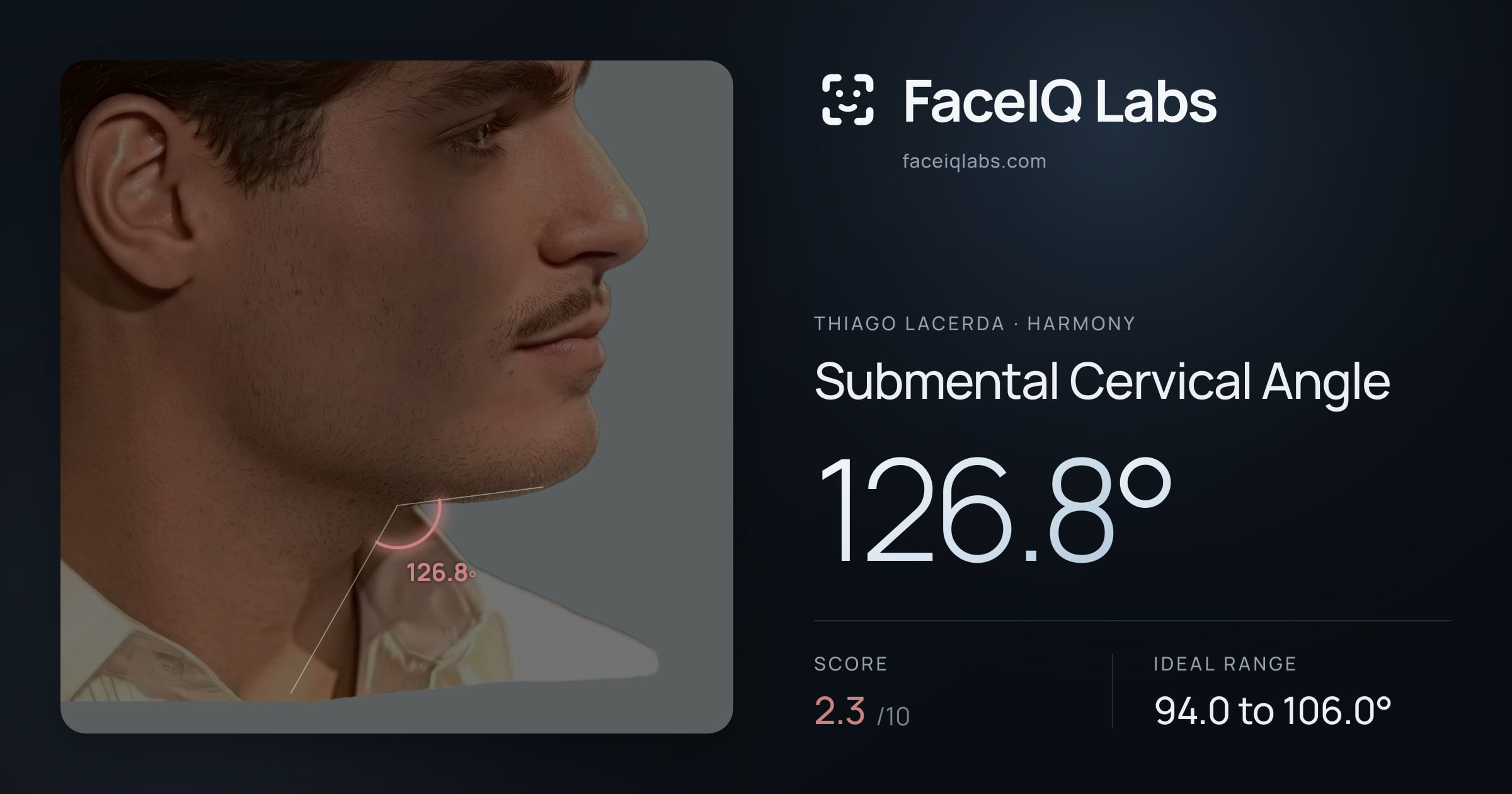 Thiago Lacerda Submental Cervical Angle: 126.8°, drawn on the photo