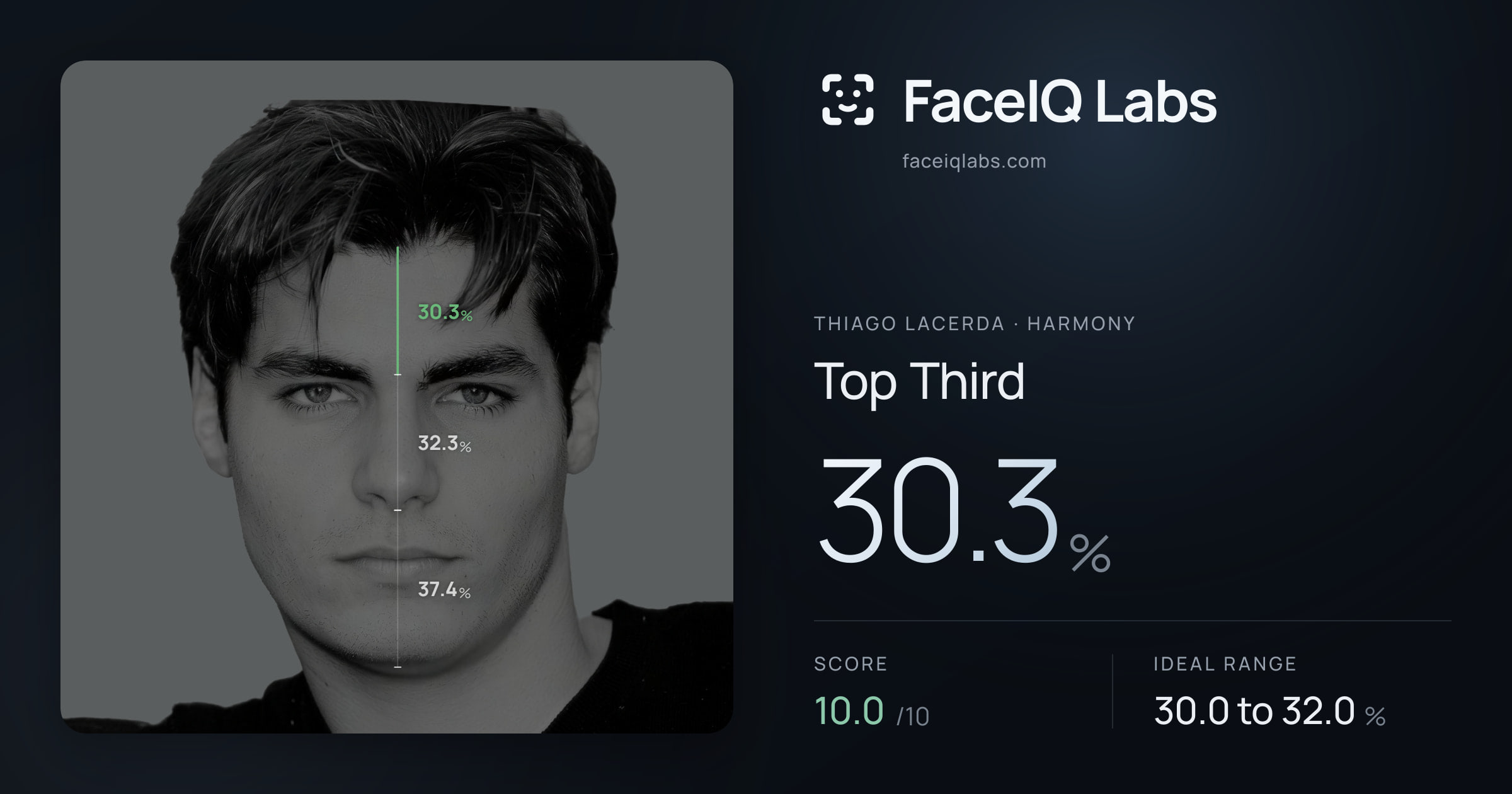 Thiago Lacerda Top Third: 30.3%, drawn on the photo