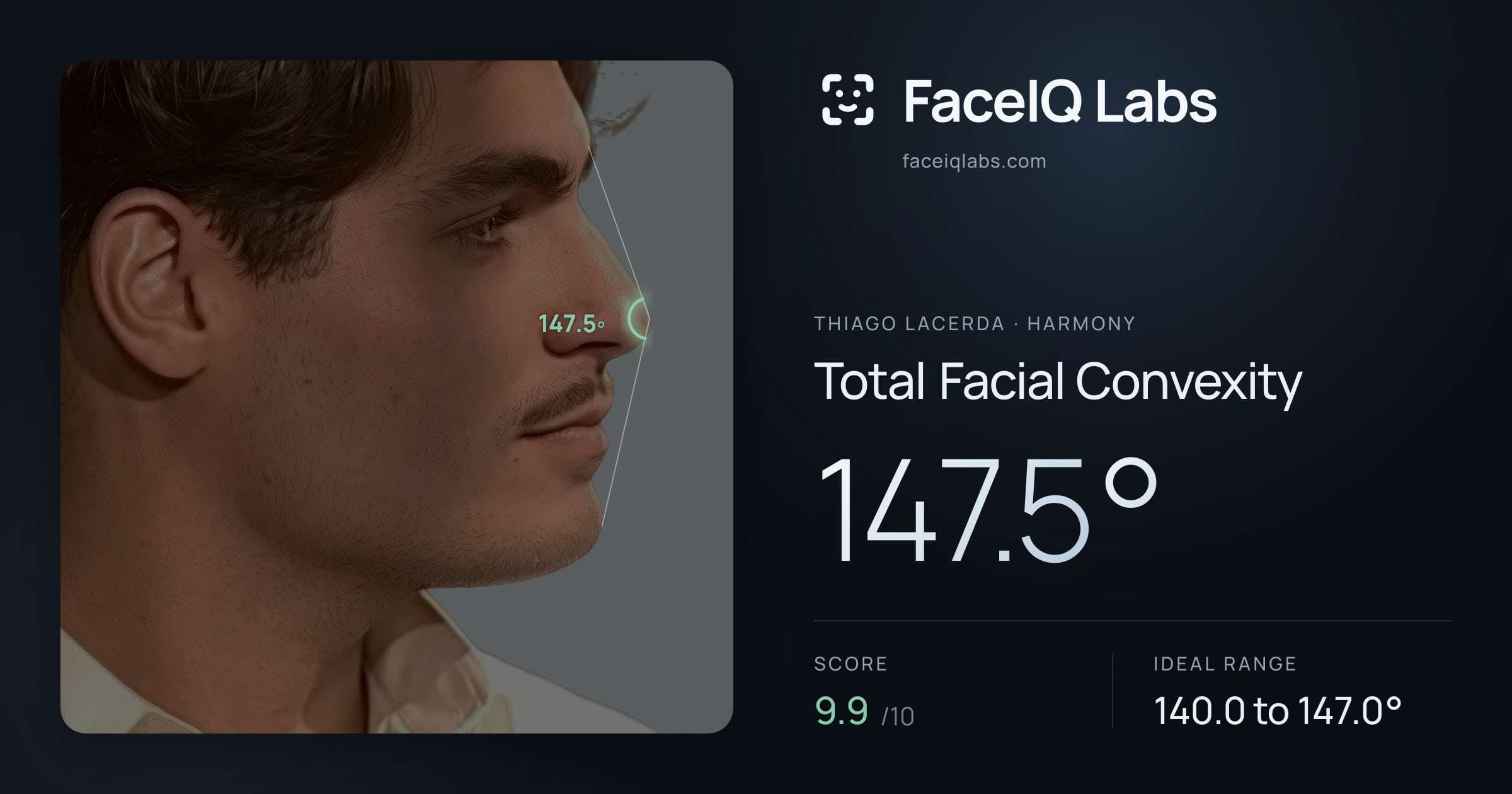 Thiago Lacerda Total Facial Convexity: 147.5°, drawn on the photo