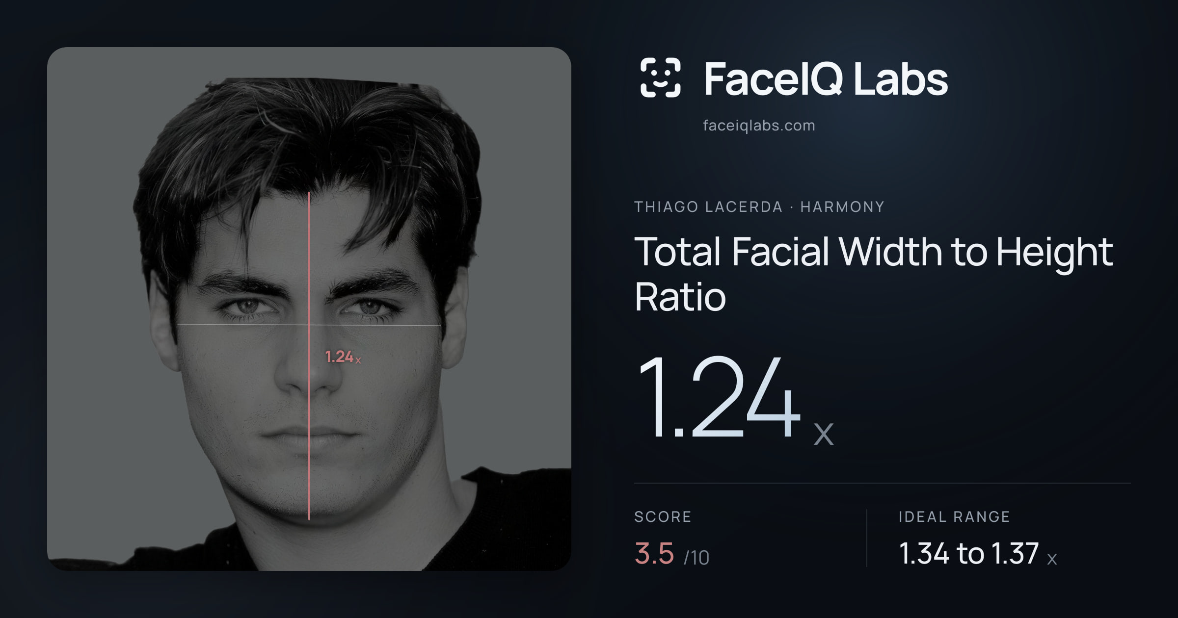 Thiago Lacerda Total Facial Width to Height Ratio: 1.24x, drawn on the photo