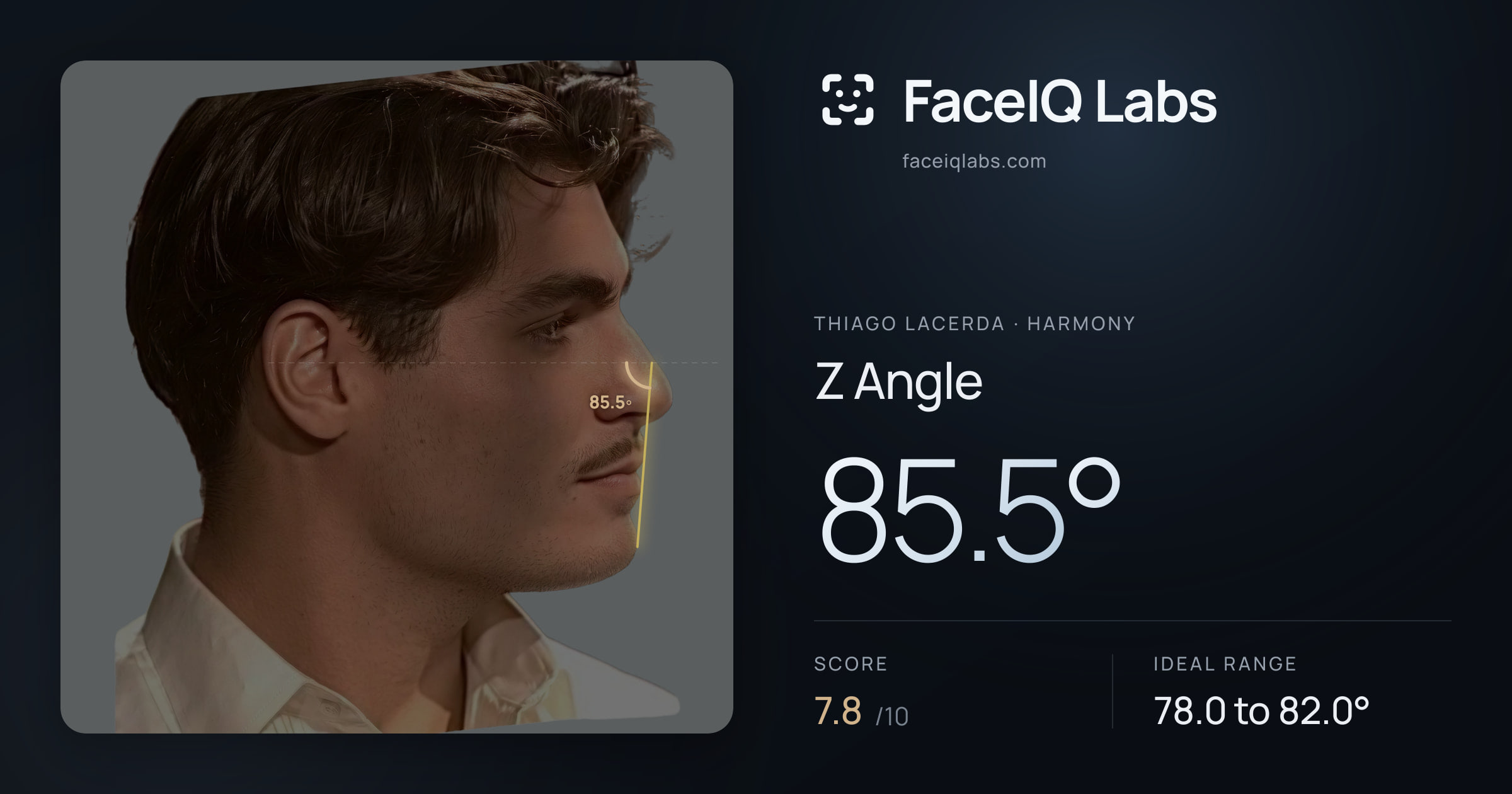 Thiago Lacerda Z Angle: 85.5°, drawn on the photo