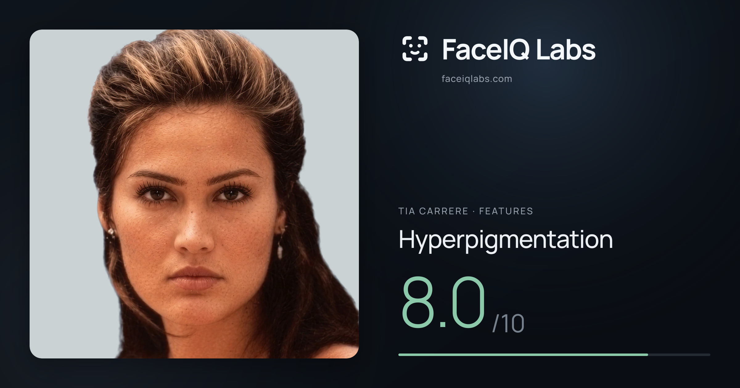 Tia Carrere Hyperpigmentation: 8.0/10, drawn on the photo