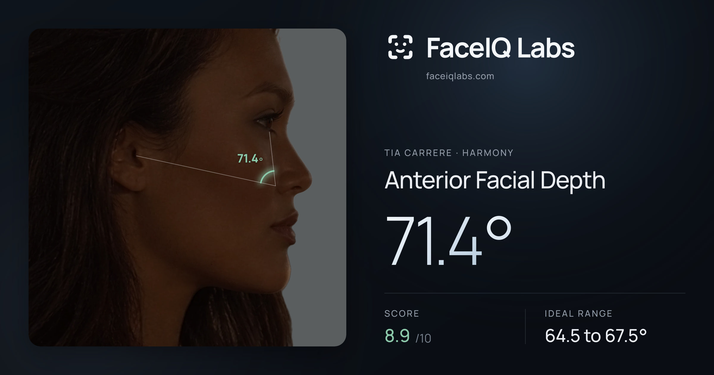 Tia Carrere Anterior Facial Depth: 71.4°, drawn on the photo
