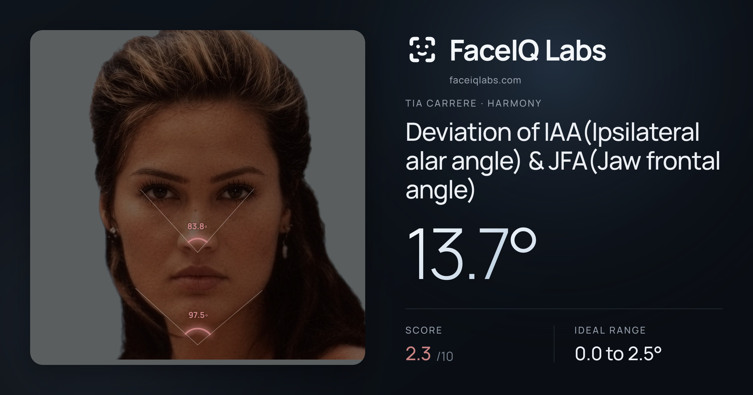 Tia Carrere Deviation of IAA(Ipsilateral alar angle) & JFA(Jaw frontal angle): 13.7°, drawn on the photo