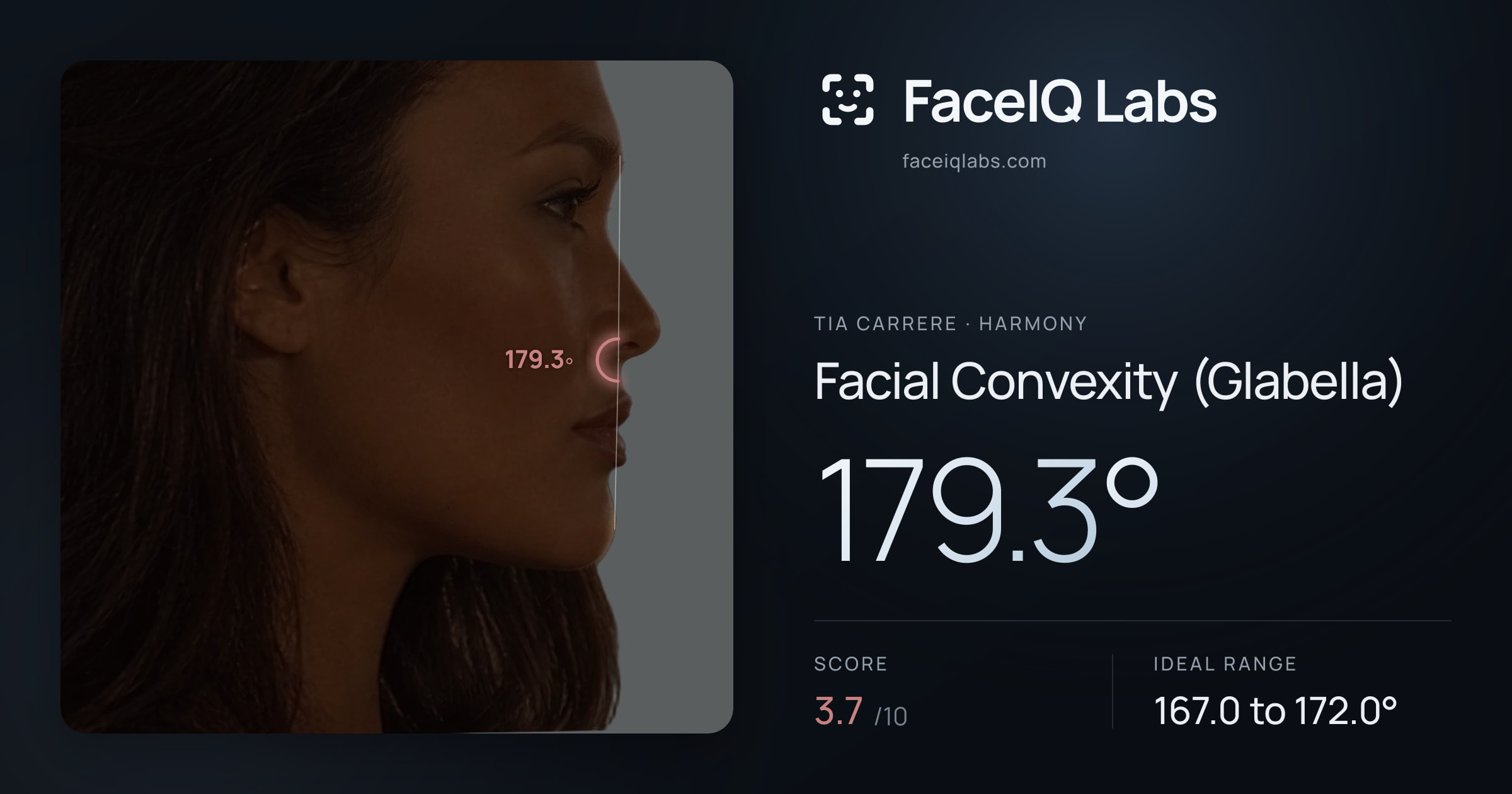 Tia Carrere Facial Convexity (Glabella): 179.3°, drawn on the photo