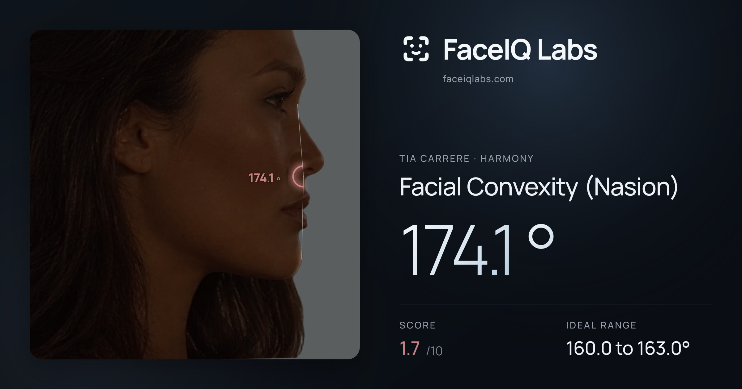 Tia Carrere Facial Convexity (Nasion): 174.1°, drawn on the photo