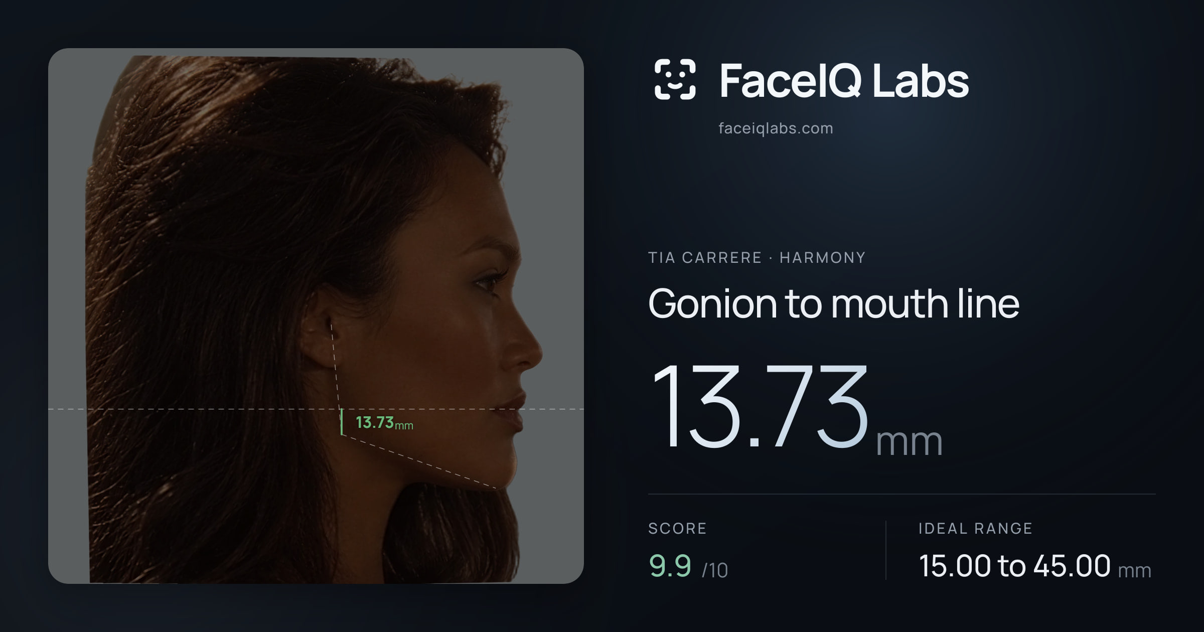 Tia Carrere Gonion to mouth line: 13.73mm, drawn on the photo