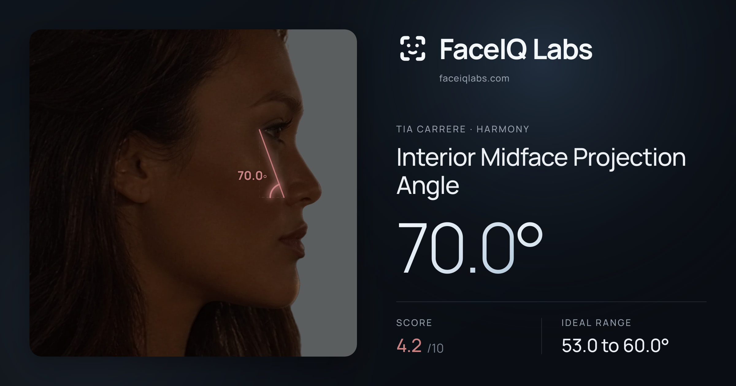 Tia Carrere Interior Midface Projection Angle: 70.0°, drawn on the photo