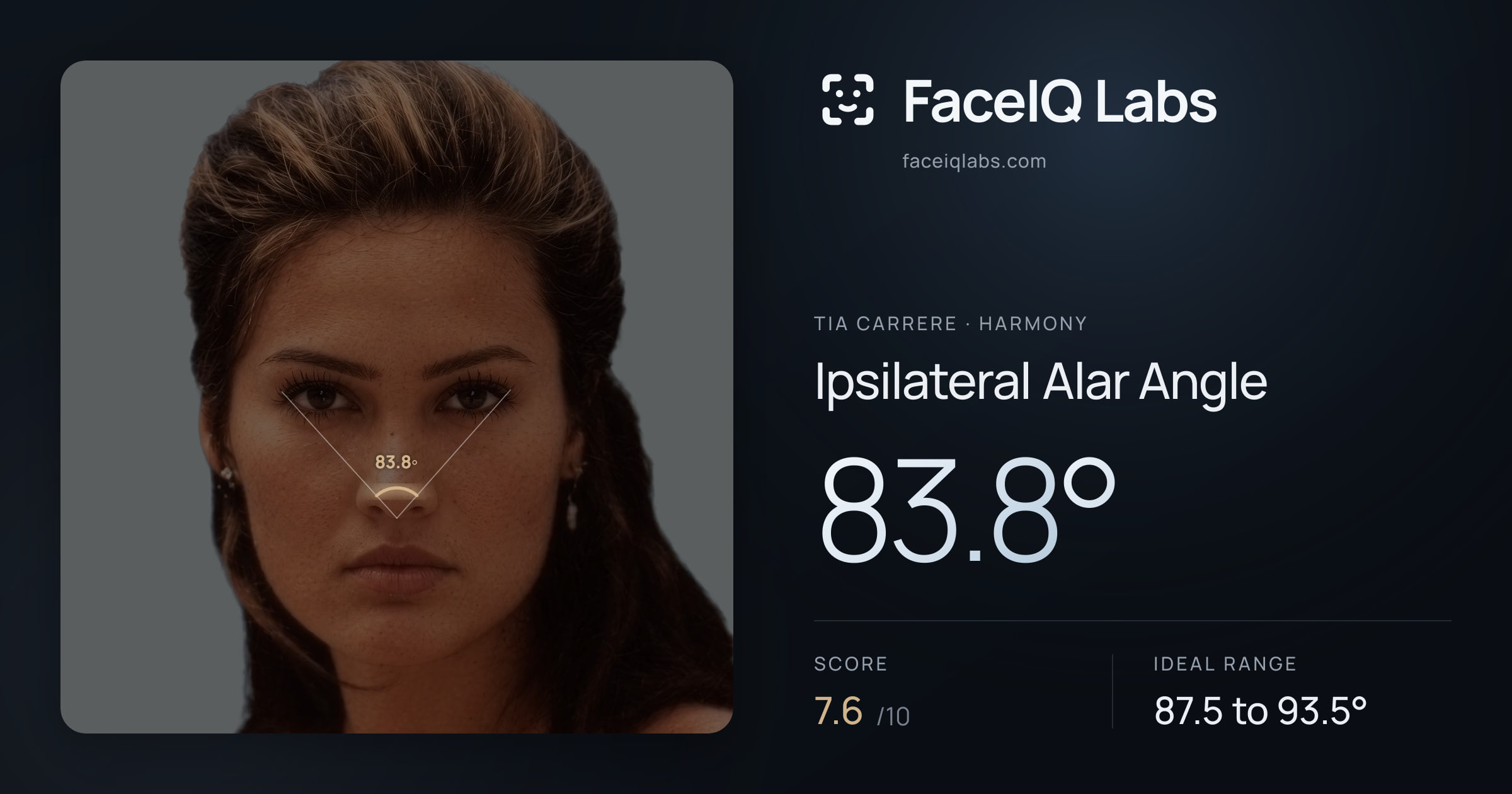 Tia Carrere Ipsilateral Alar Angle: 83.8°, drawn on the photo