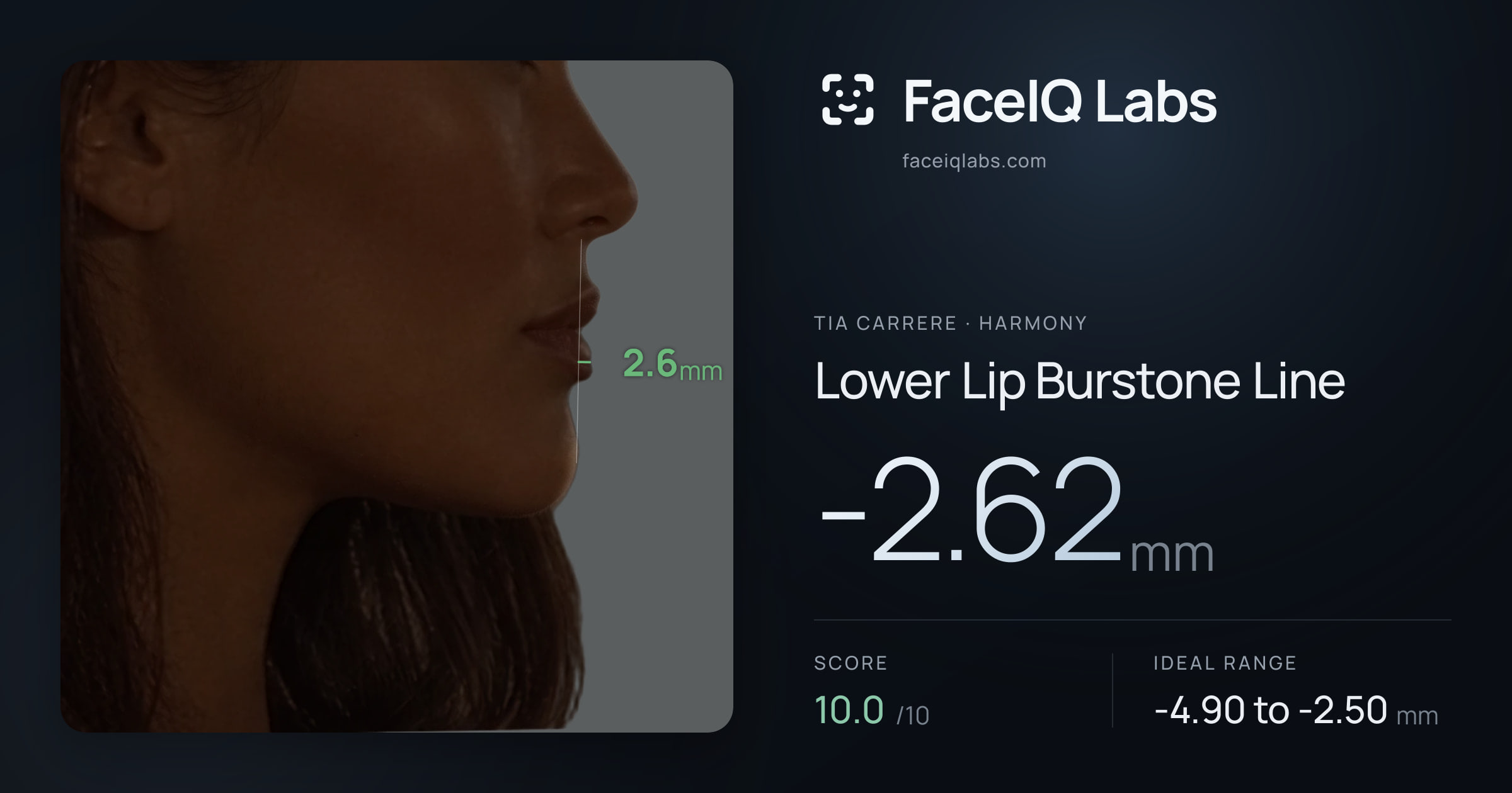 Tia Carrere Lower Lip Burstone Line: -2.62mm, drawn on the photo