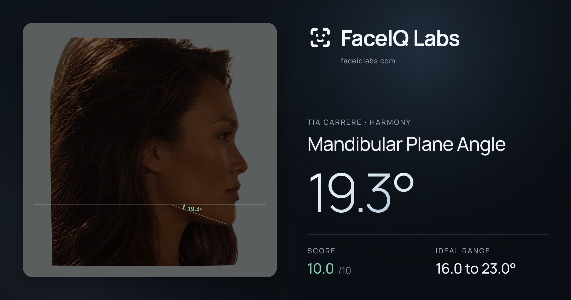 Tia Carrere Mandibular Plane Angle: 19.3°, drawn on the photo