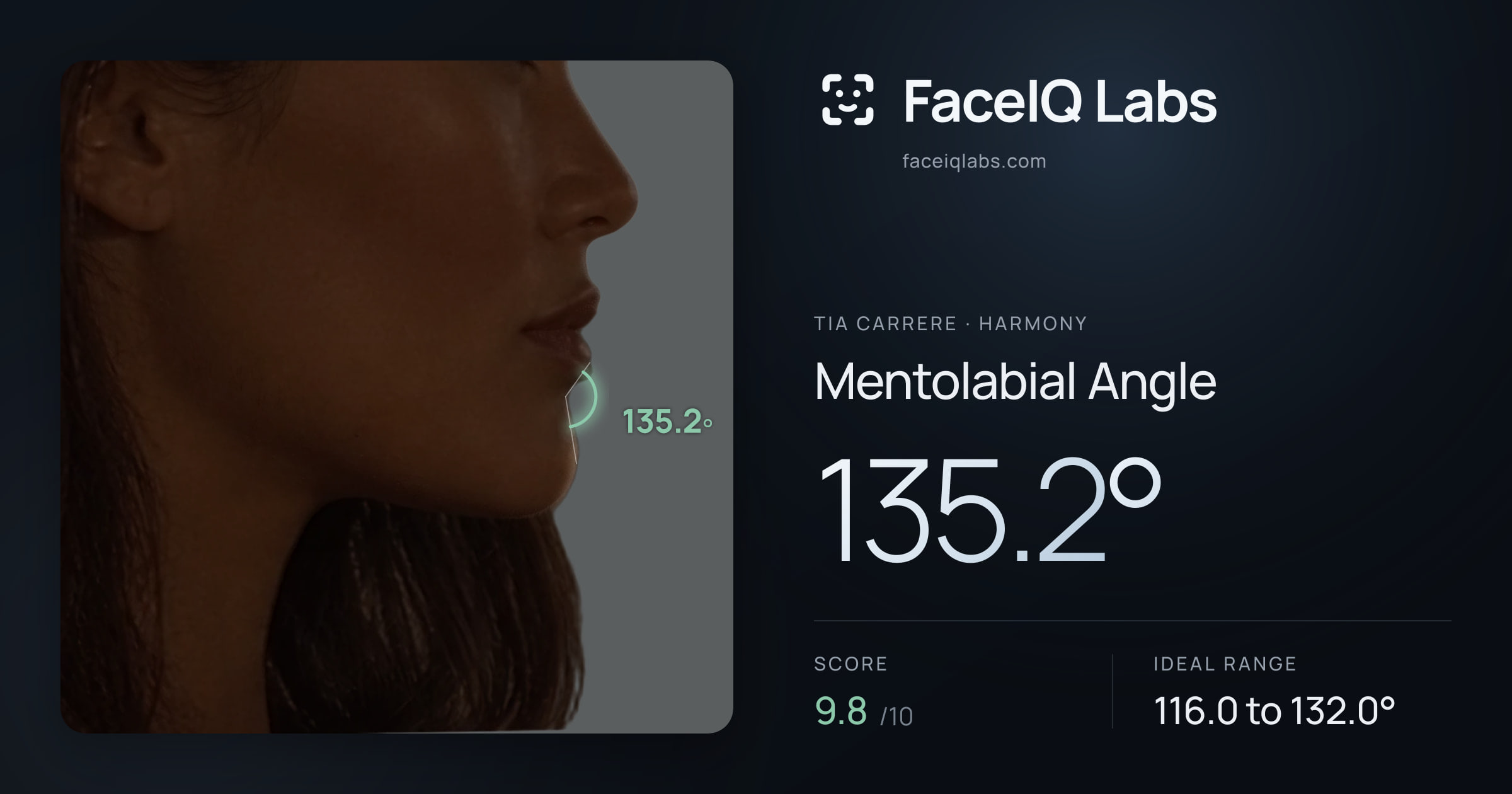 Tia Carrere Mentolabial Angle: 135.2°, drawn on the photo