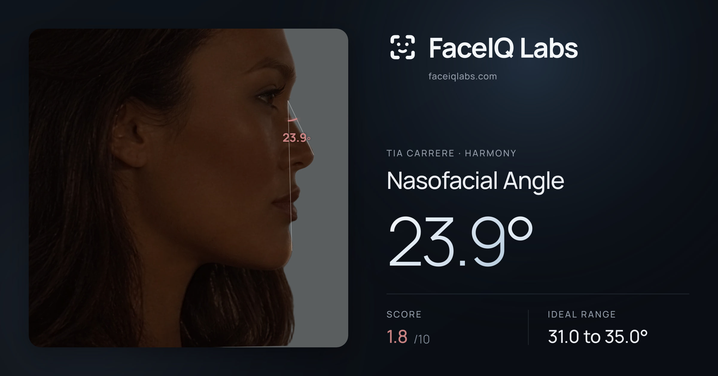 Tia Carrere Nasofacial Angle: 23.9°, drawn on the photo