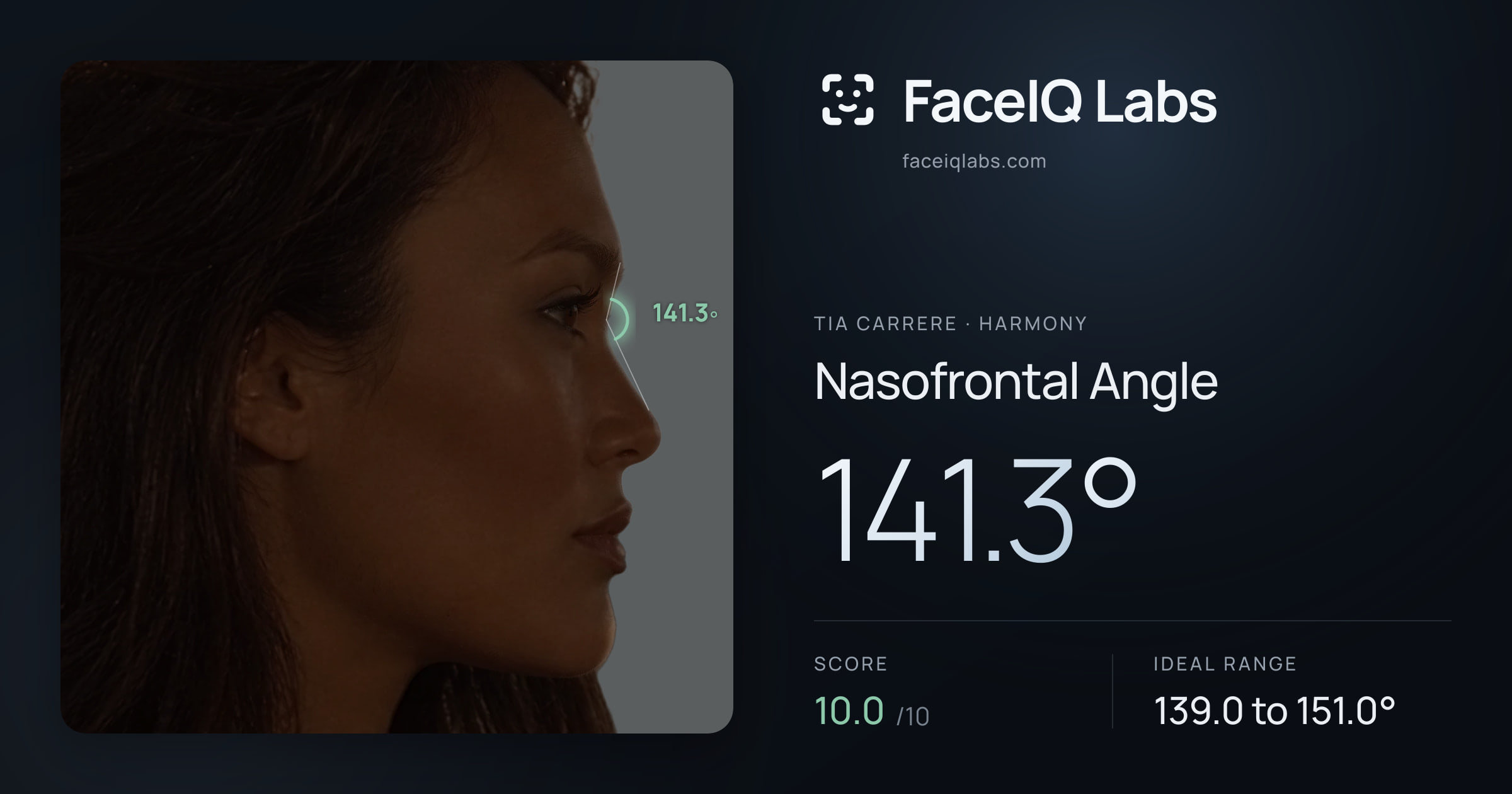 Tia Carrere Nasofrontal Angle: 141.3°, drawn on the photo