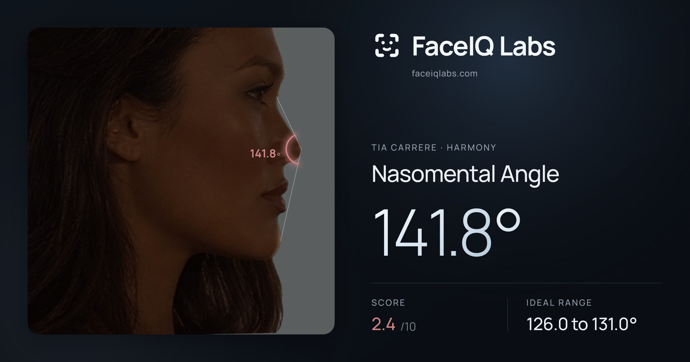 Tia Carrere Nasomental Angle: 141.8°, drawn on the photo