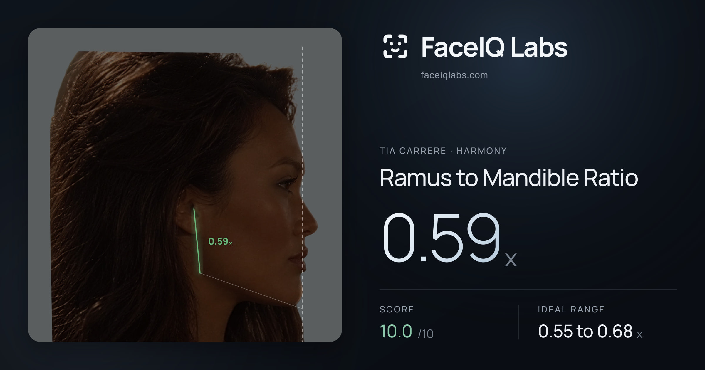 Tia Carrere Ramus to Mandible Ratio: 0.59x, drawn on the photo