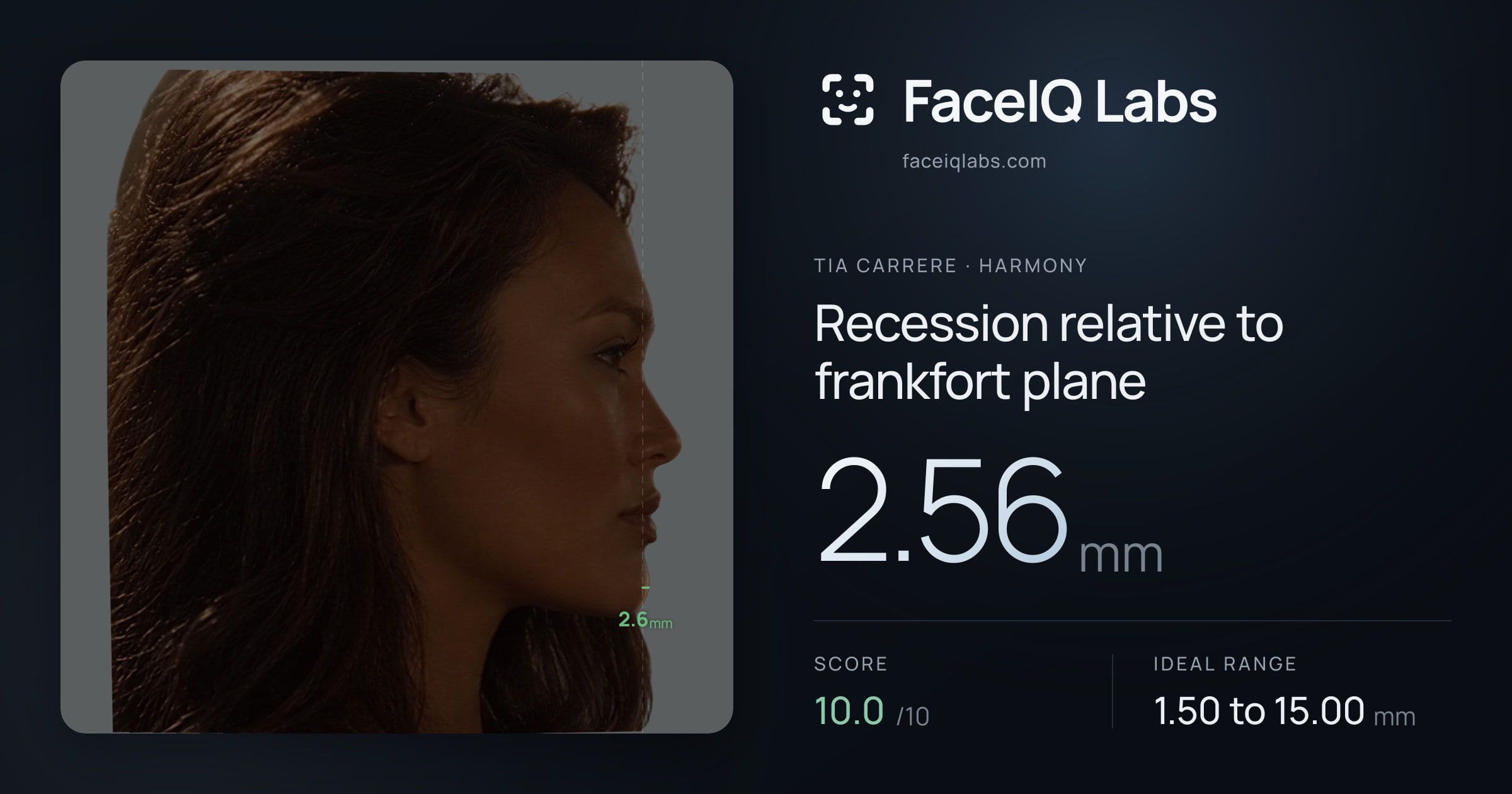 Tia Carrere Recession relative to frankfort plane: 2.56mm, drawn on the photo