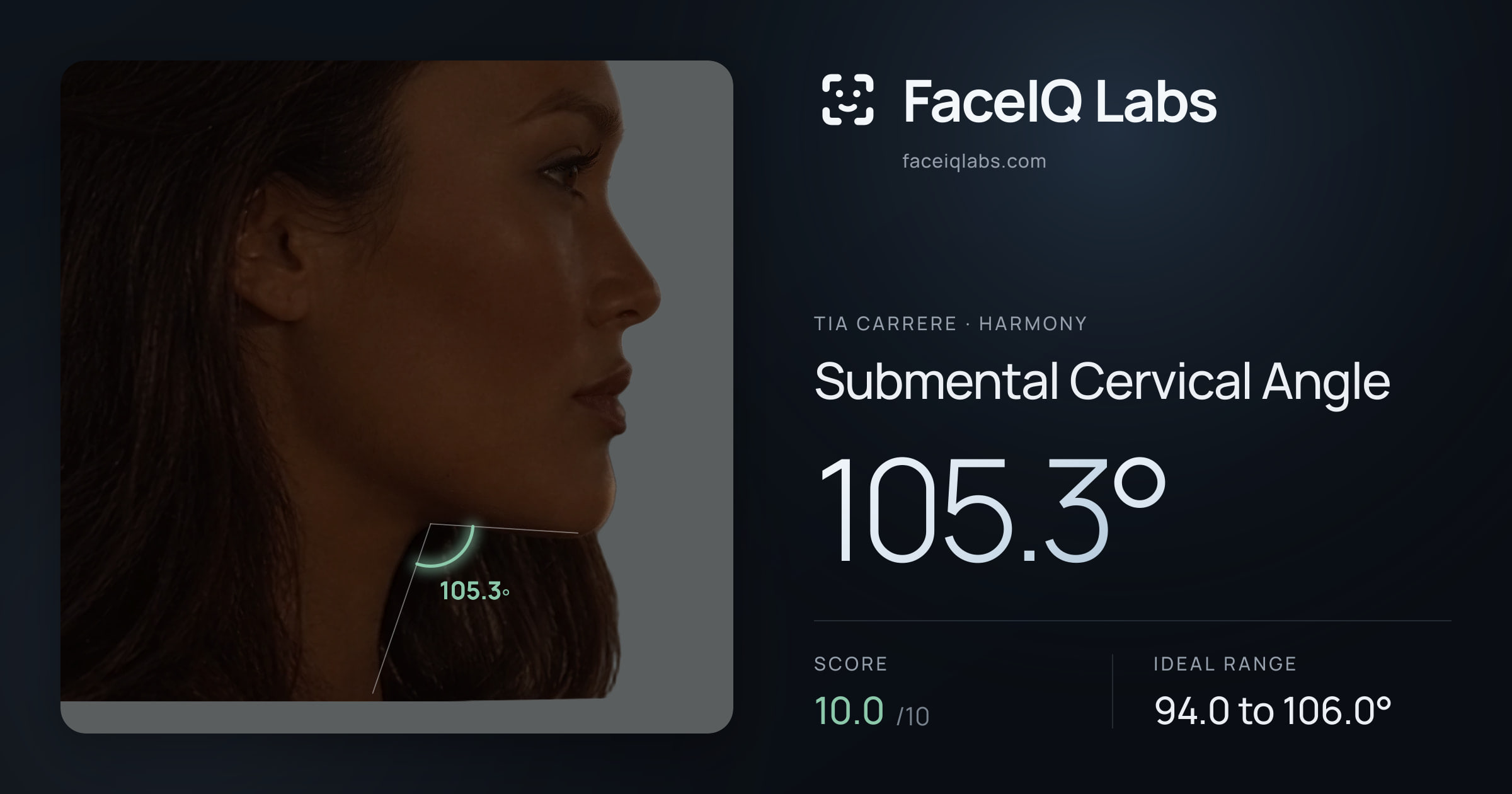 Tia Carrere Submental Cervical Angle: 105.3°, drawn on the photo