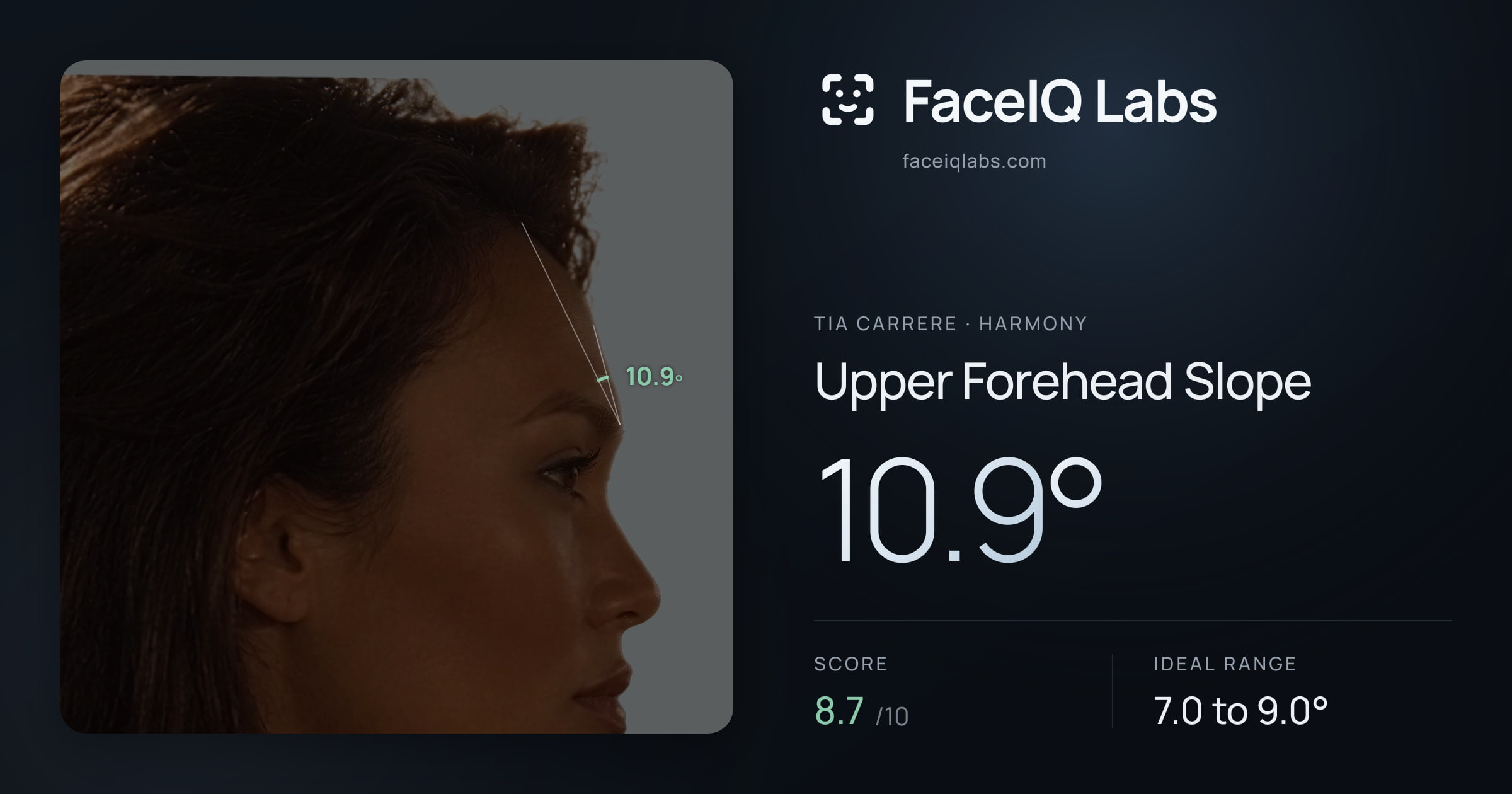 Tia Carrere Upper Forehead Slope: 10.9°, drawn on the photo