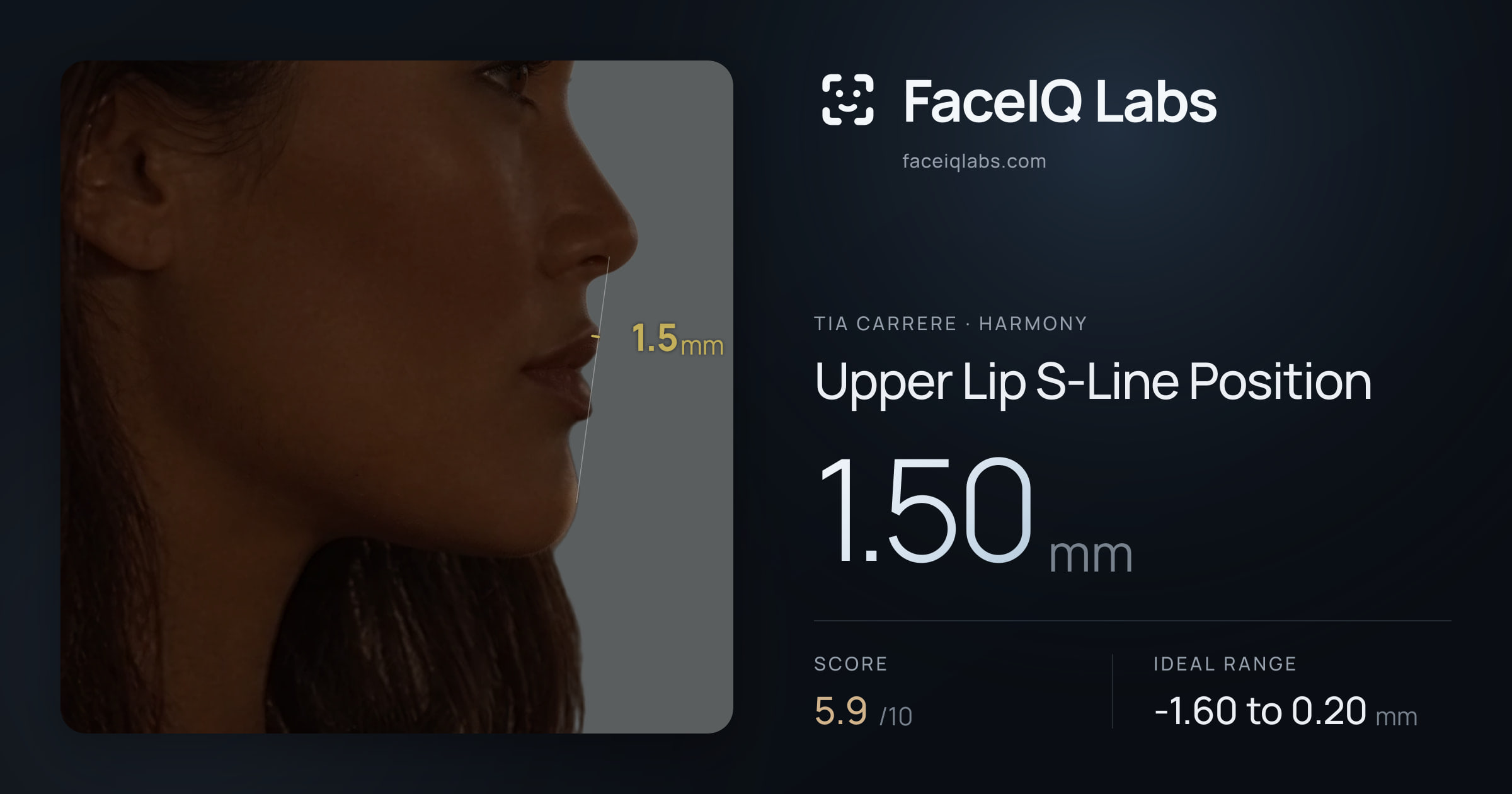 Tia Carrere Upper Lip S-Line Position: 1.50mm, drawn on the photo