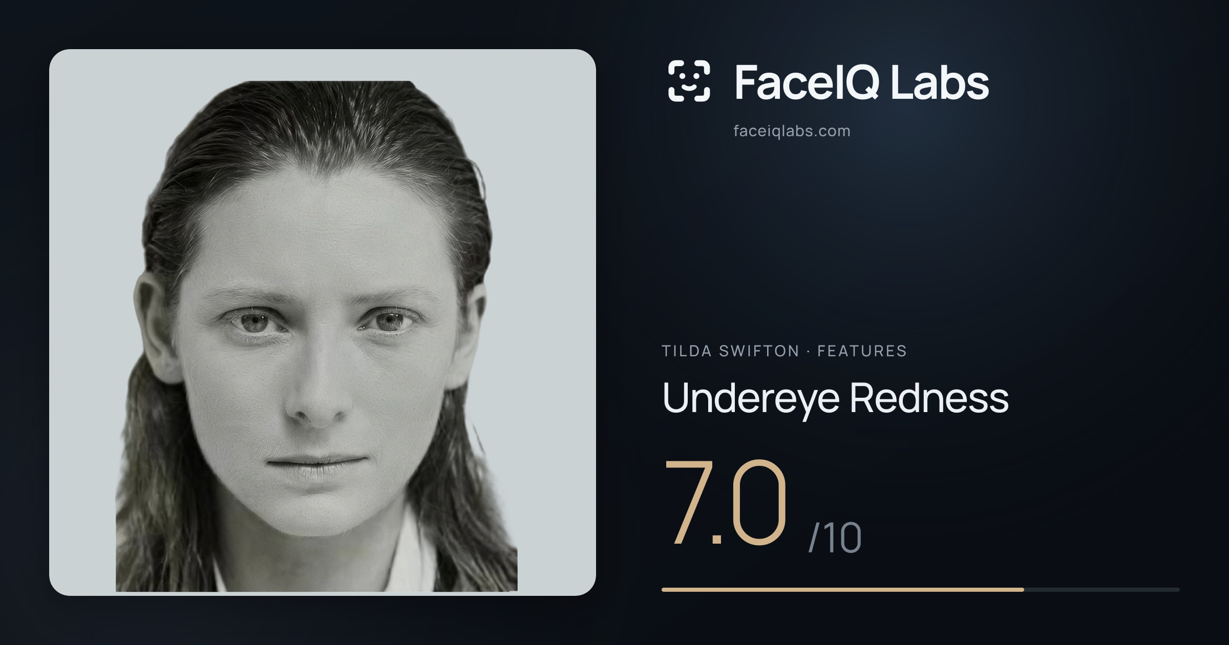 Tilda Swifton Undereye Redness: 7.0/10, drawn on the photo
