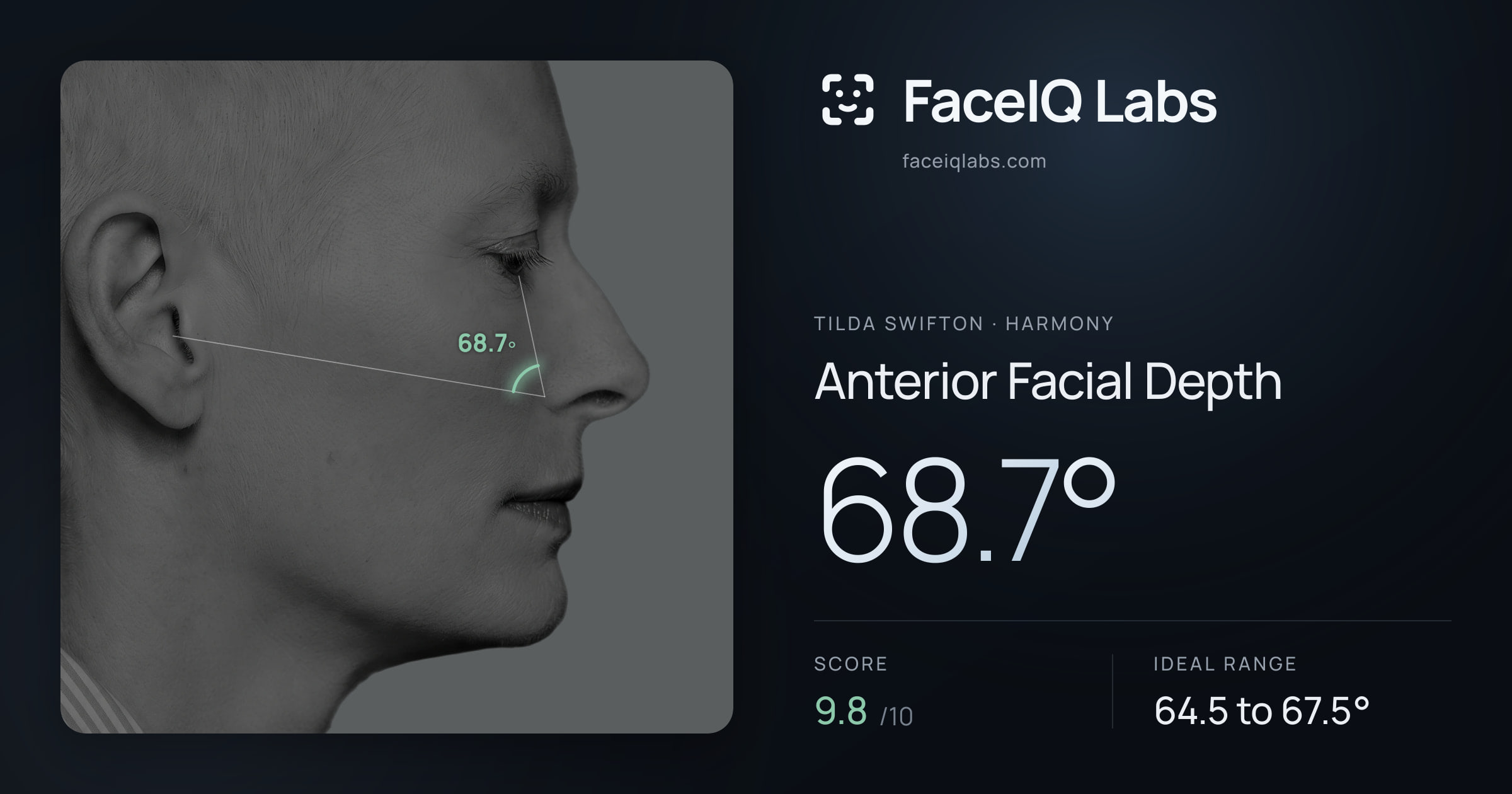 Tilda Swifton Anterior Facial Depth: 68.7°, drawn on the photo