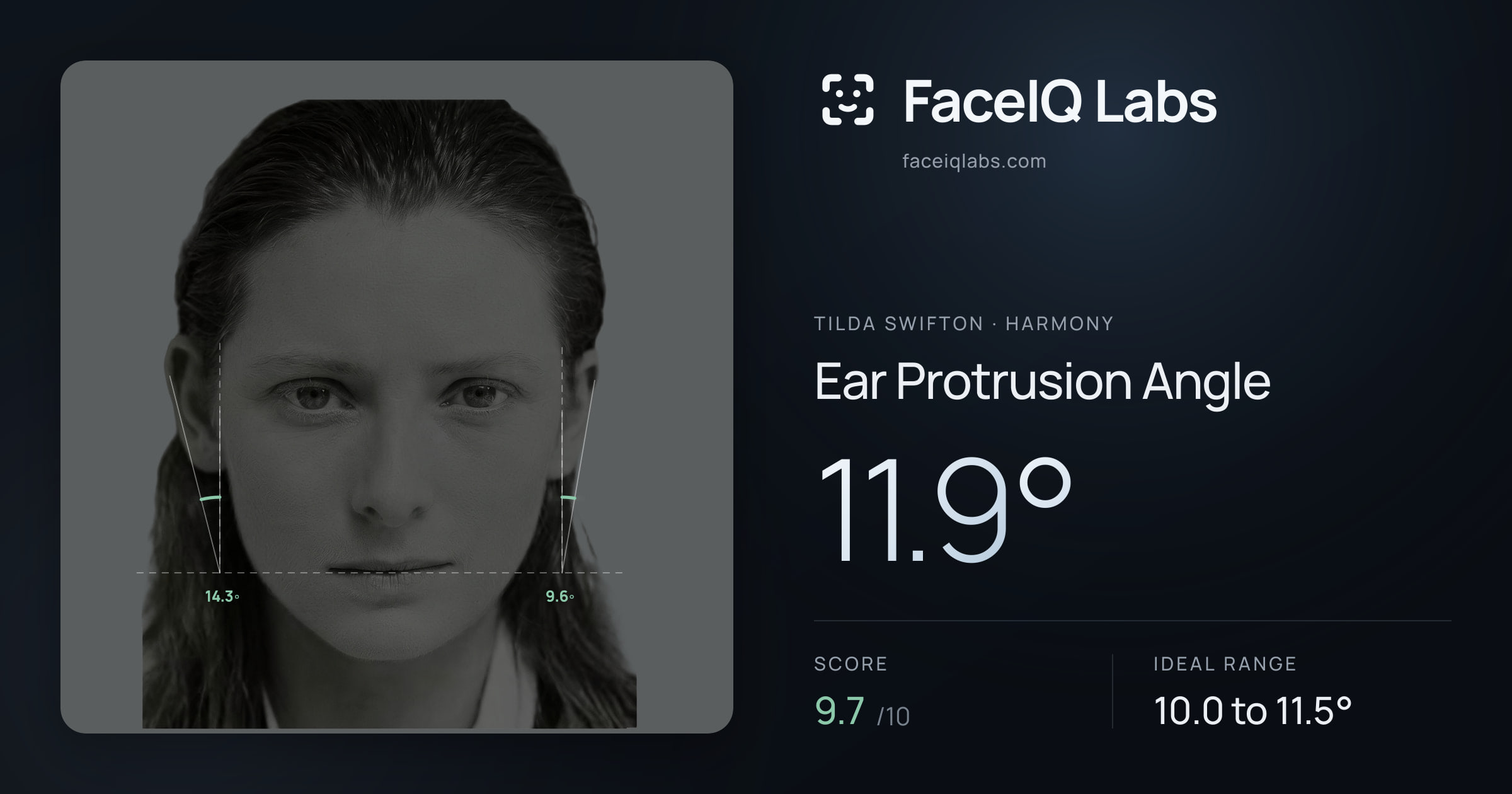 Tilda Swifton Ear Protrusion Angle: 11.9°, drawn on the photo