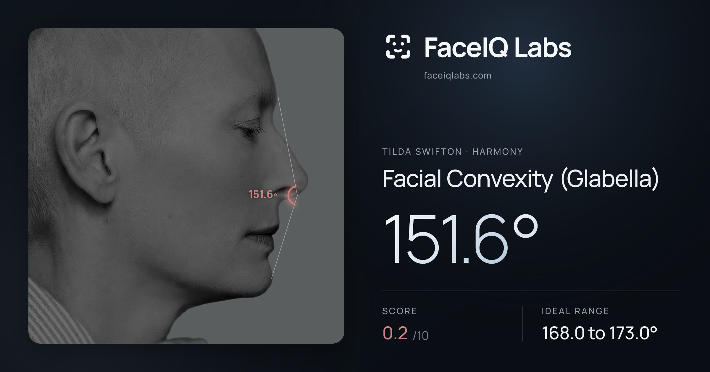 Tilda Swifton Facial Convexity (Glabella): 151.6°, drawn on the photo