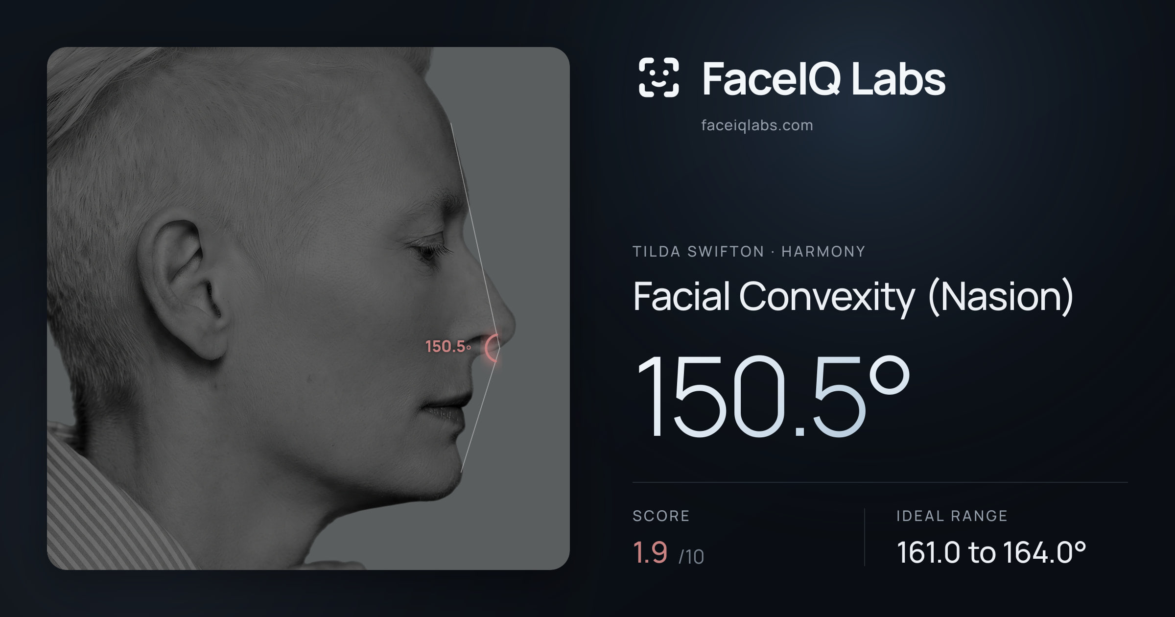 Tilda Swifton Facial Convexity (Nasion): 150.5°, drawn on the photo