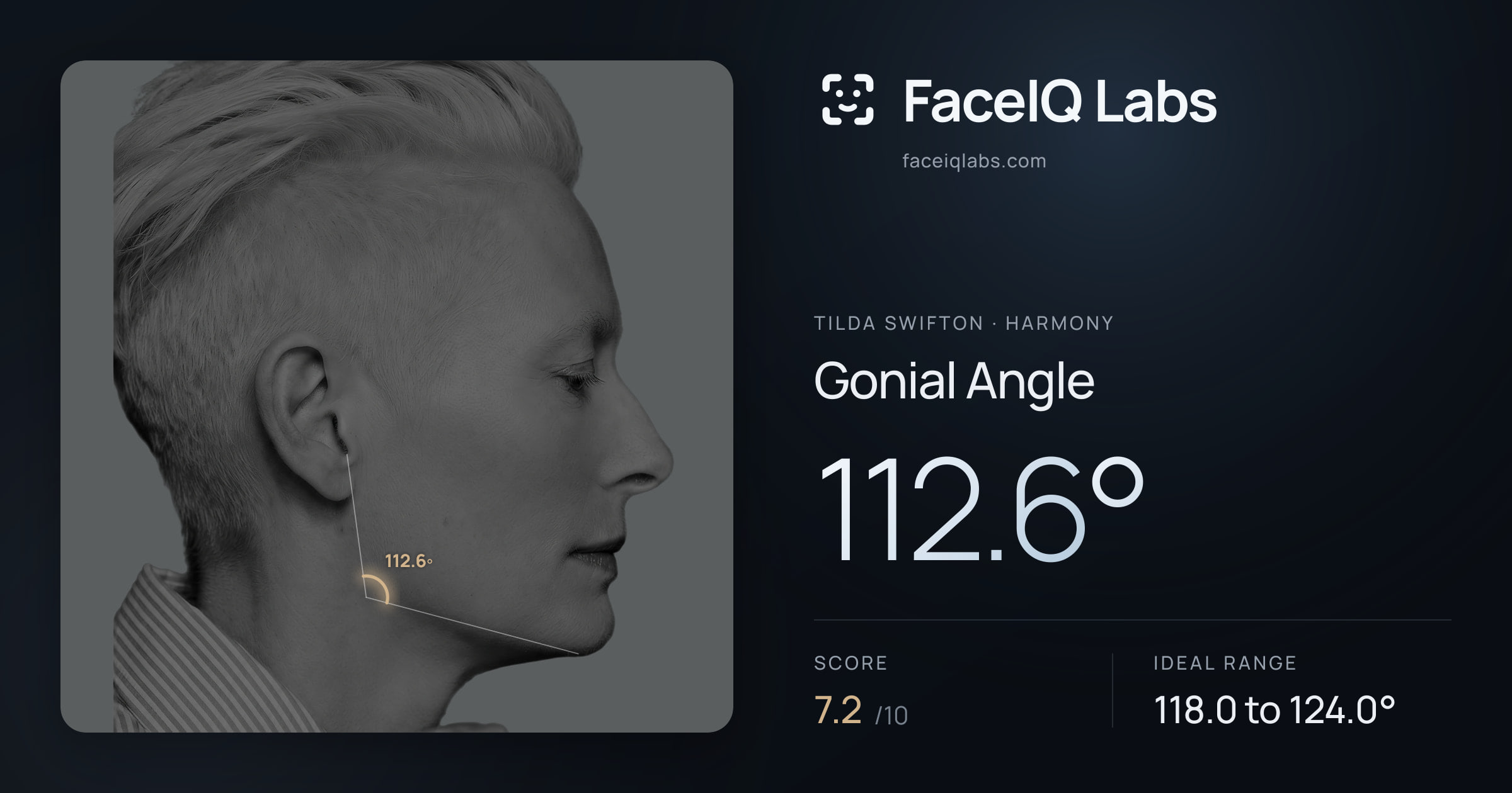 Tilda Swifton Gonial Angle: 112.6°, drawn on the photo