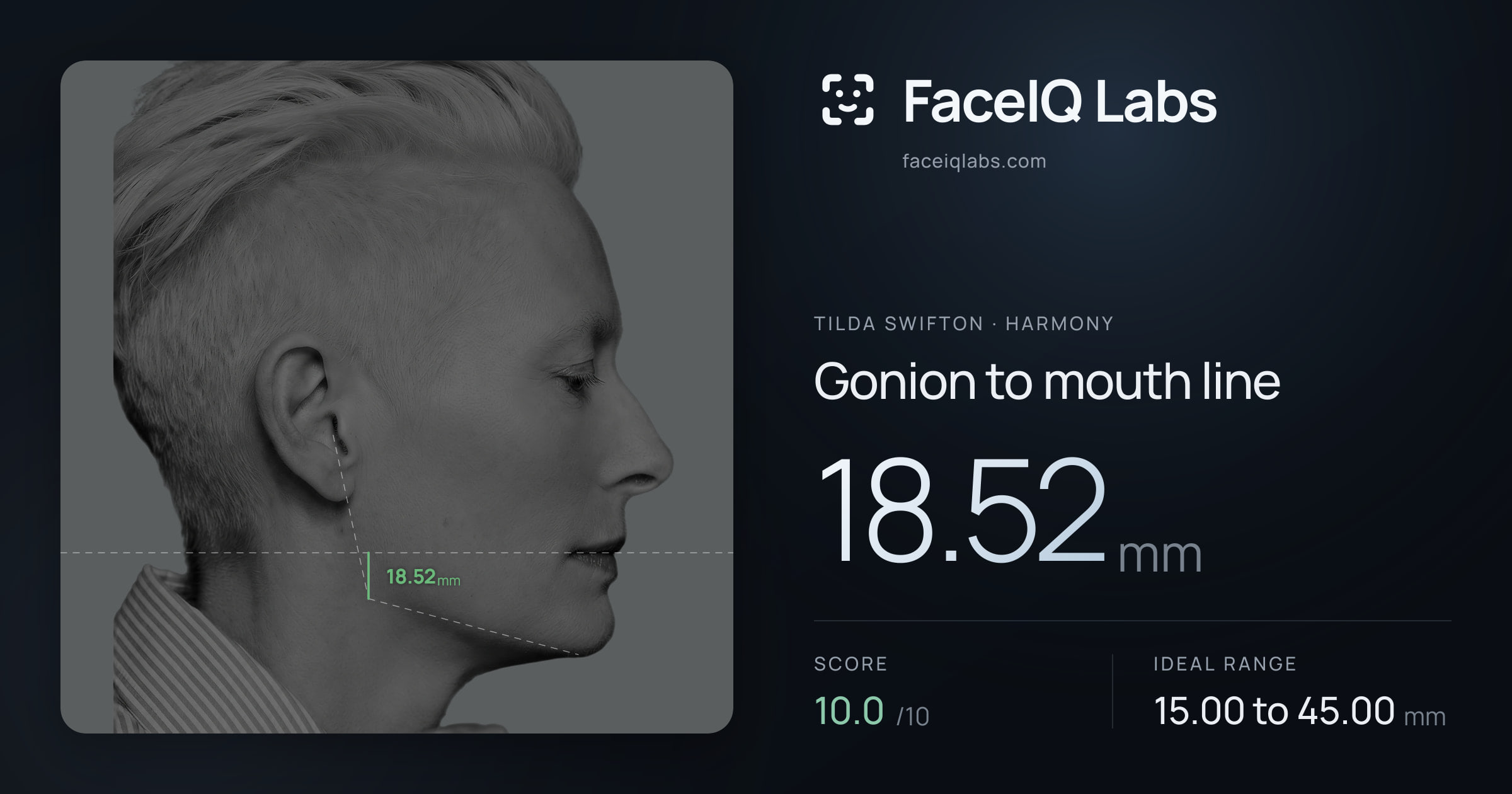 Tilda Swifton Gonion to mouth line: 18.52mm, drawn on the photo