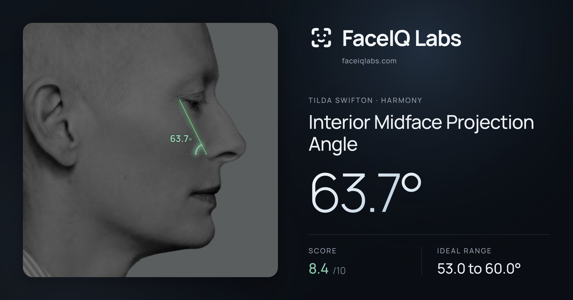Tilda Swifton Interior Midface Projection Angle: 63.7°, drawn on the photo
