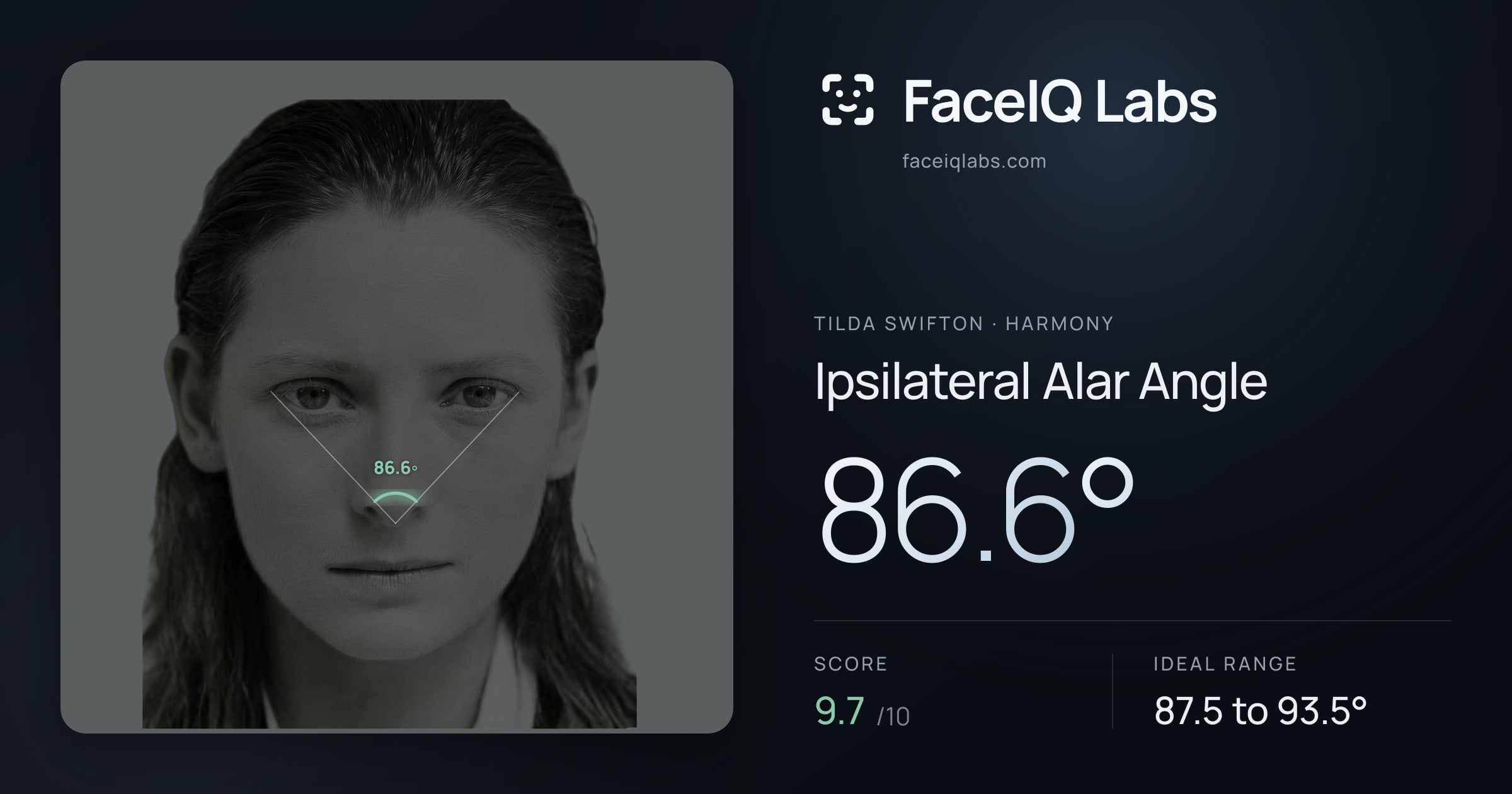 Tilda Swifton Ipsilateral Alar Angle: 86.6°, drawn on the photo