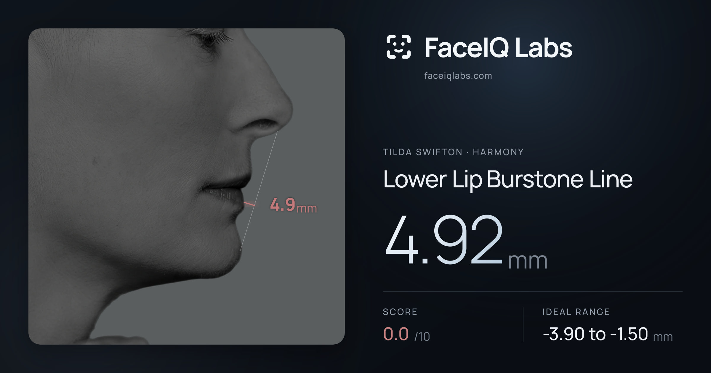Tilda Swifton Lower Lip Burstone Line: 4.92mm, drawn on the photo