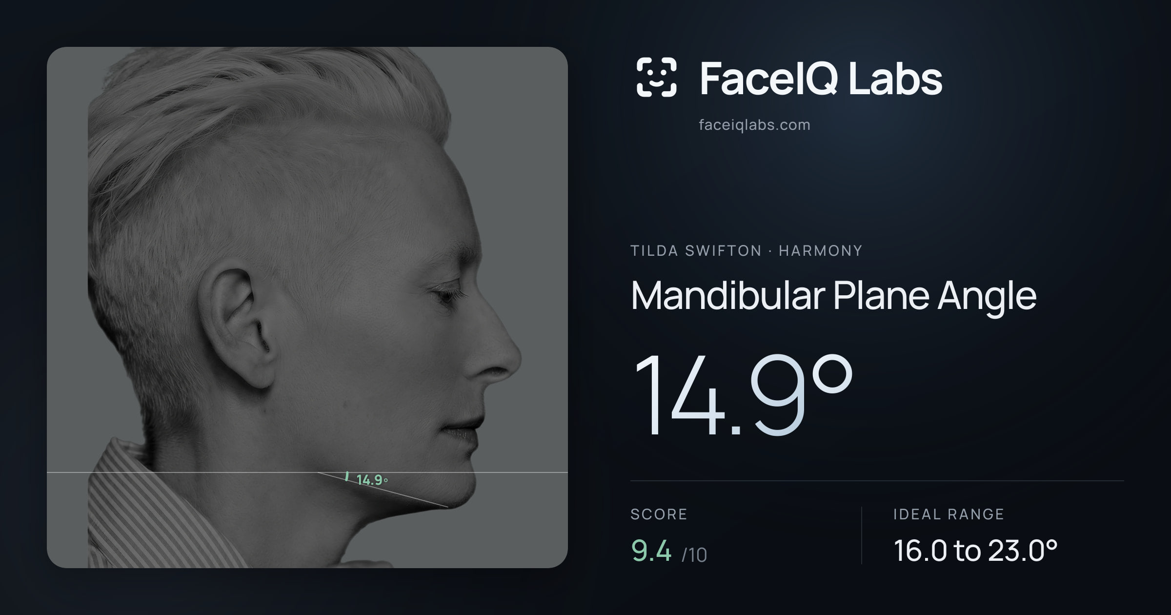 Tilda Swifton Mandibular Plane Angle: 14.9°, drawn on the photo