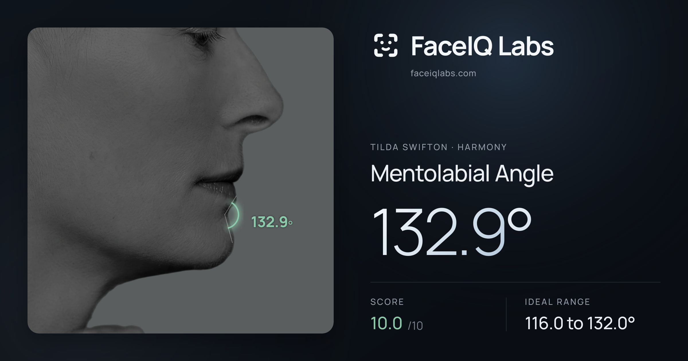 Tilda Swifton Mentolabial Angle: 132.9°, drawn on the photo